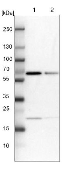 Western Blot: ARHGAP6 Antibody [NBP1-80837] - Lane 1: NIH-3T3 cell lysate (Mouse embryonic fibroblast cells)<br/>Lane 2: NBT-II cell lysate (Rat Wistar bladder tumour cells)