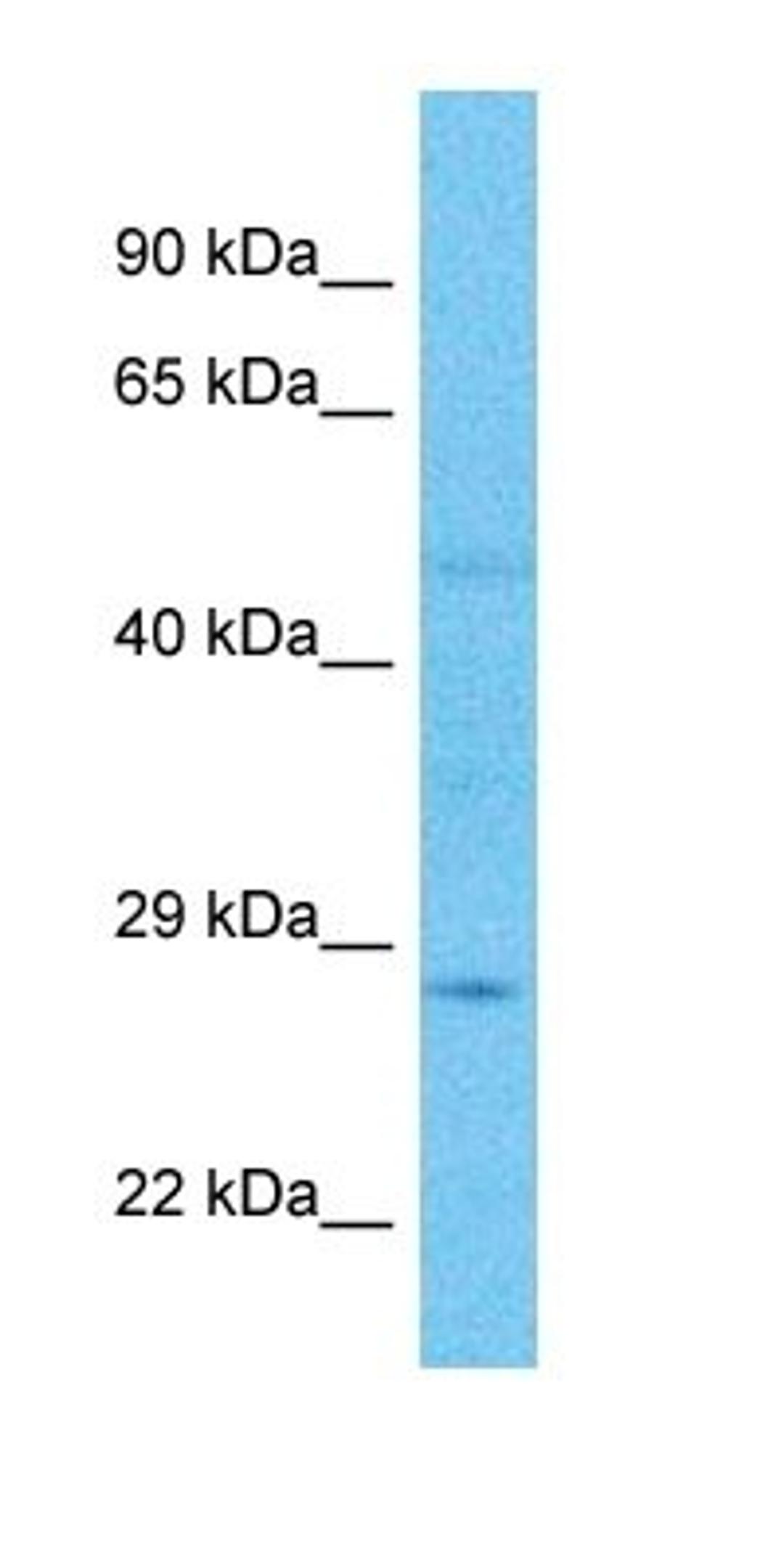 Western blot analysis of human Large intestine Tumor tissue using CEL2A antibody