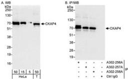 Detection of human CKAP4 by western blot and immunoprecipitation.