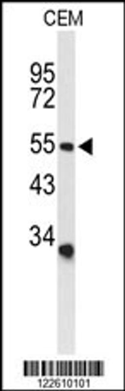 Western blot analysis of ACCN2 Antibody in CEM cell line lysates (35ug/lane)