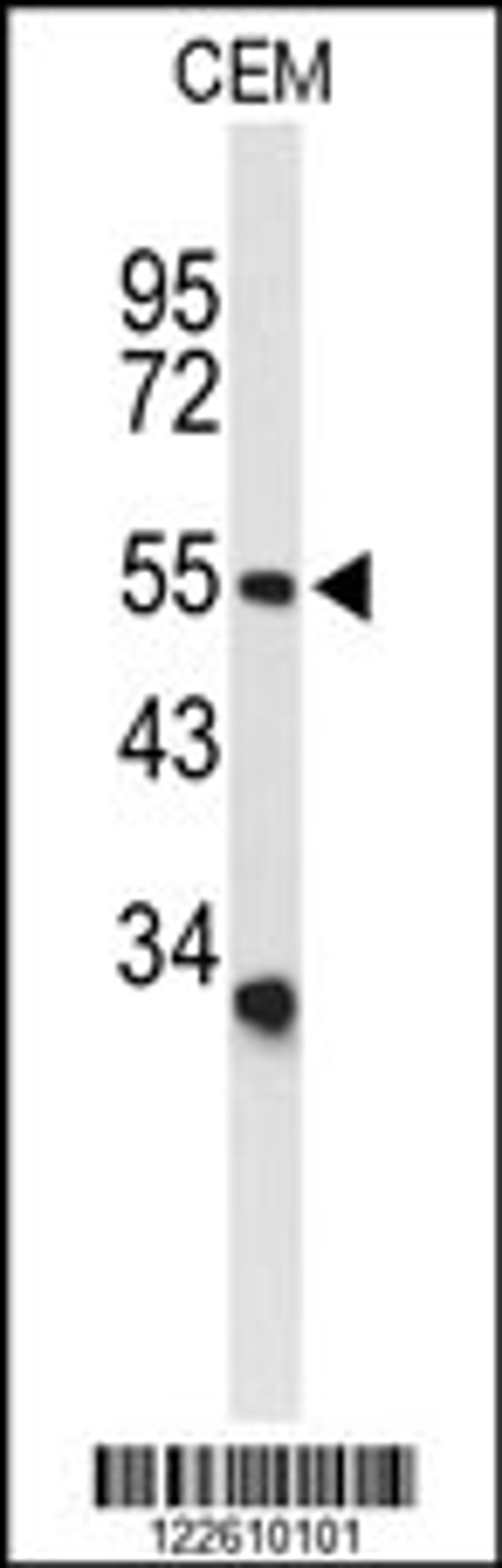 Western blot analysis of ACCN2 Antibody in CEM cell line lysates (35ug/lane)