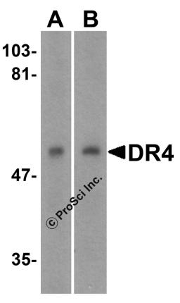 <strong>Figure 1 Western Blot Validation in Human Cell Lines</strong><br>
Loading: 15 &#956;g of lysates per lane.
Antibodies: DR4 1139 (1 &#956;g/mL), 1h incubation at RT in 5% NFDM/TBST.
Secondary: Goat anti-rabbit IgG HRP conjugate at 1:10000 dilution.