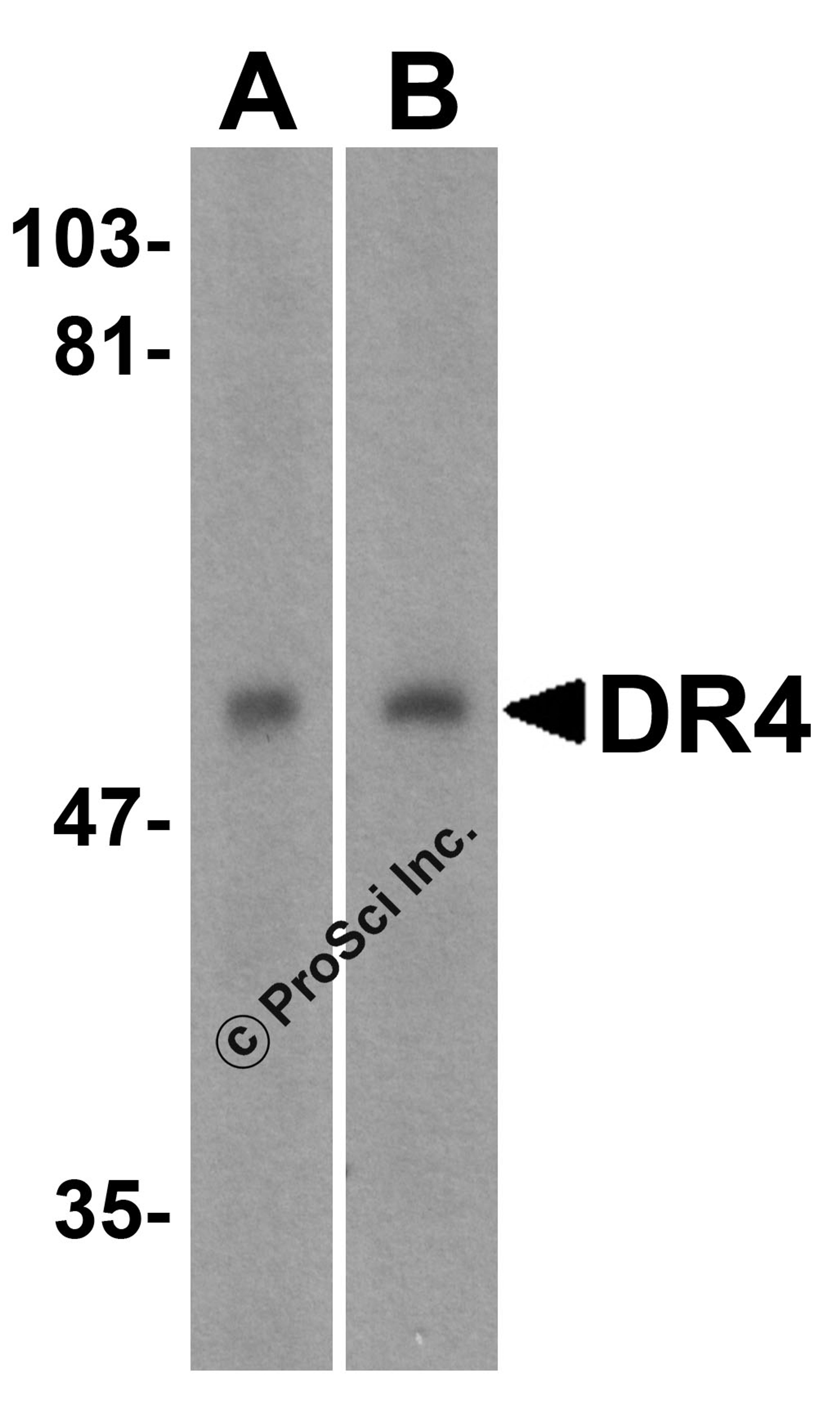 <strong>Figure 1 Western Blot Validation in Human Cell Lines</strong><br>
Loading: 15 &#956;g of lysates per lane.
Antibodies: DR4 1139 (1 &#956;g/mL), 1h incubation at RT in 5% NFDM/TBST.
Secondary: Goat anti-rabbit IgG HRP conjugate at 1:10000 dilution.