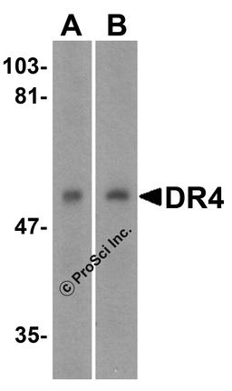 <strong>Figure 1 Western Blot Validation in Human Cell Lines</strong><br>
Loading: 15 μg of lysates per lane.
Antibodies: DR4 1139 (1 μg/mL), 1h incubation at RT in 5% NFDM/TBST.
Secondary: Goat anti-rabbit IgG HRP conjugate at 1:10000 dilution.