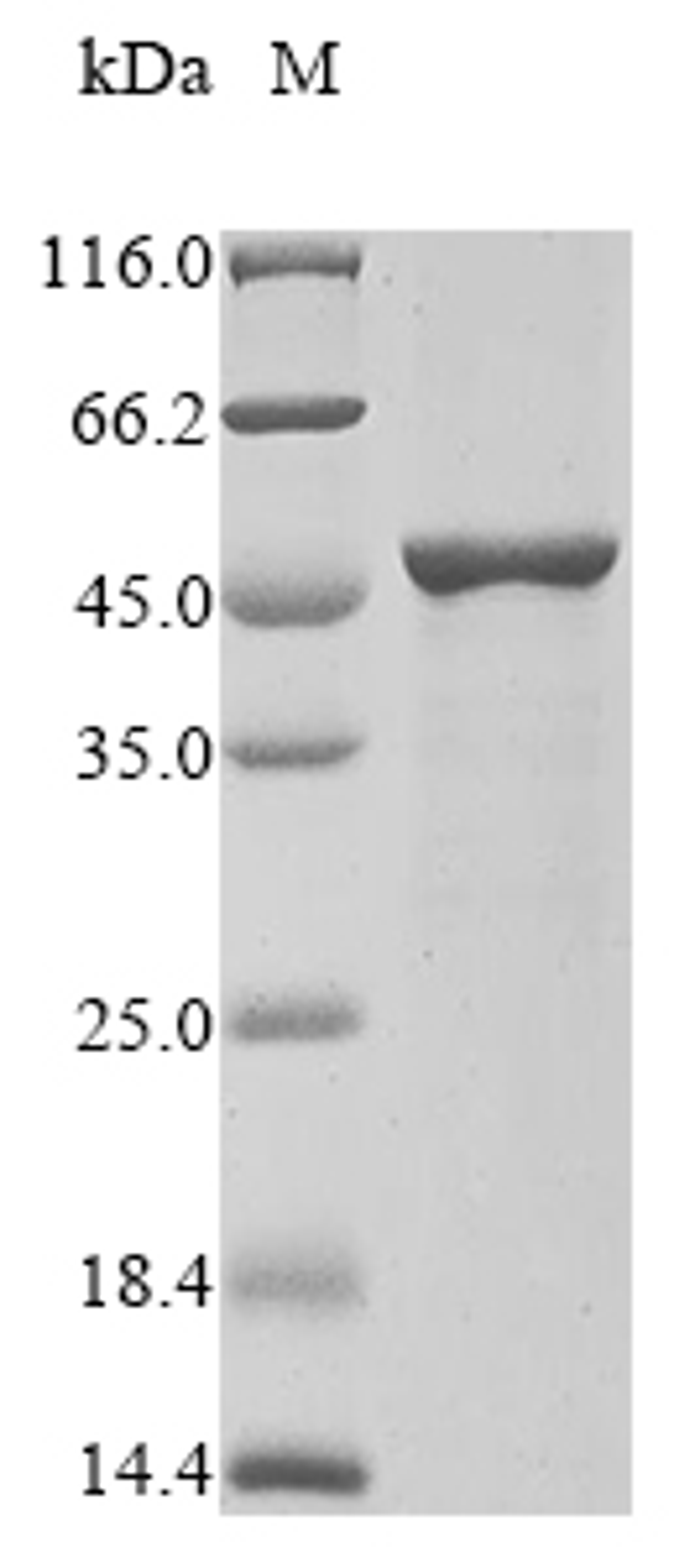 (Tris-Glycine gel) Discontinuous SDS-PAGE (reduced) with 5% enrichment gel and 15% separation gel.