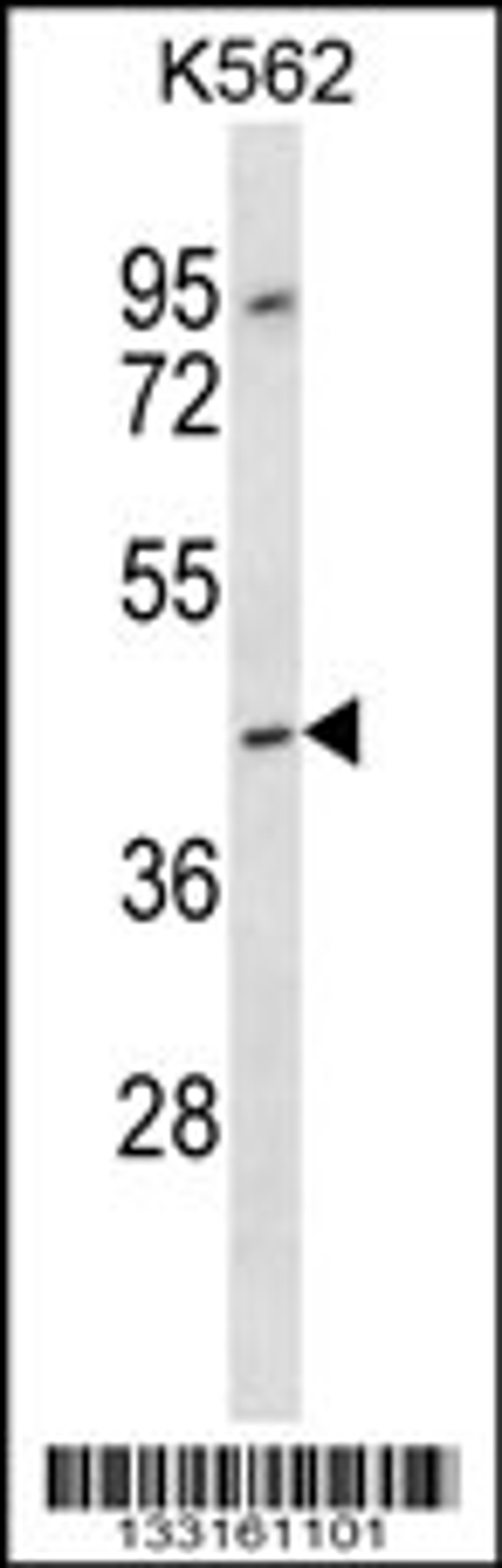 Western blot analysis in K562 cell line lysates (35ug/lane).