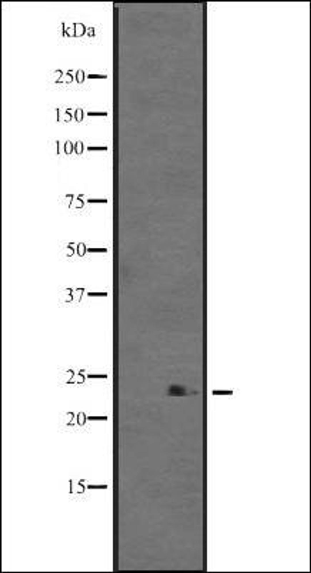 Western blot analysis of WARS2 transfected 293T cell lysate using TrpRS antibody