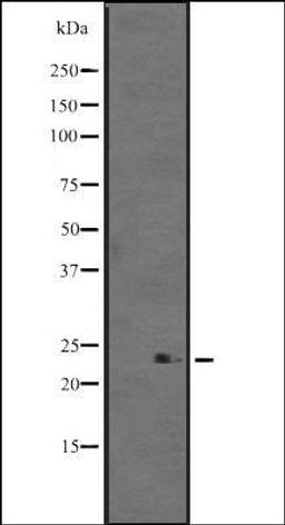 Western blot analysis of WARS2 transfected 293T cell lysate using TrpRS antibody