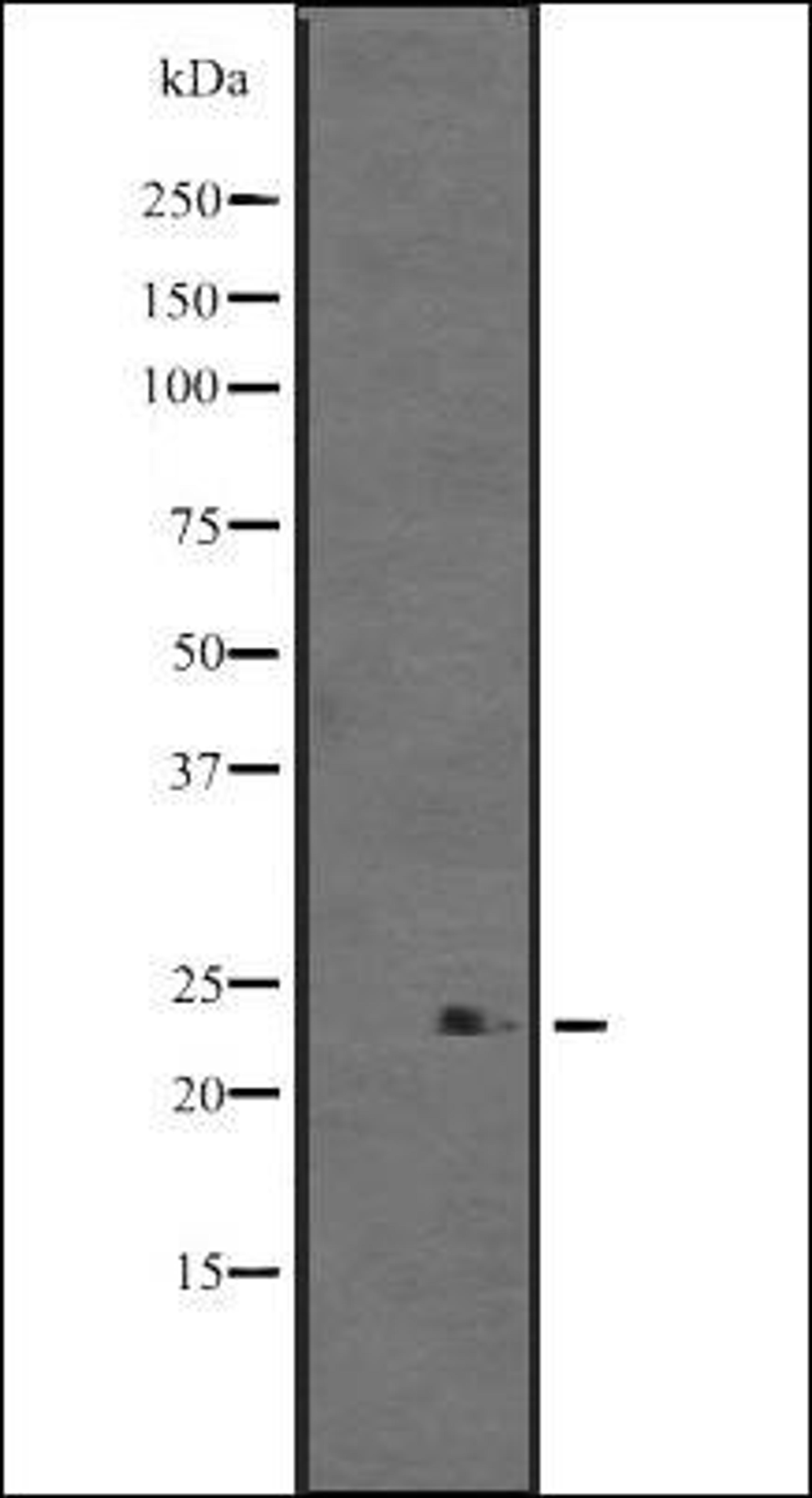 Western blot analysis of WARS2 transfected 293T cell lysate using TrpRS antibody