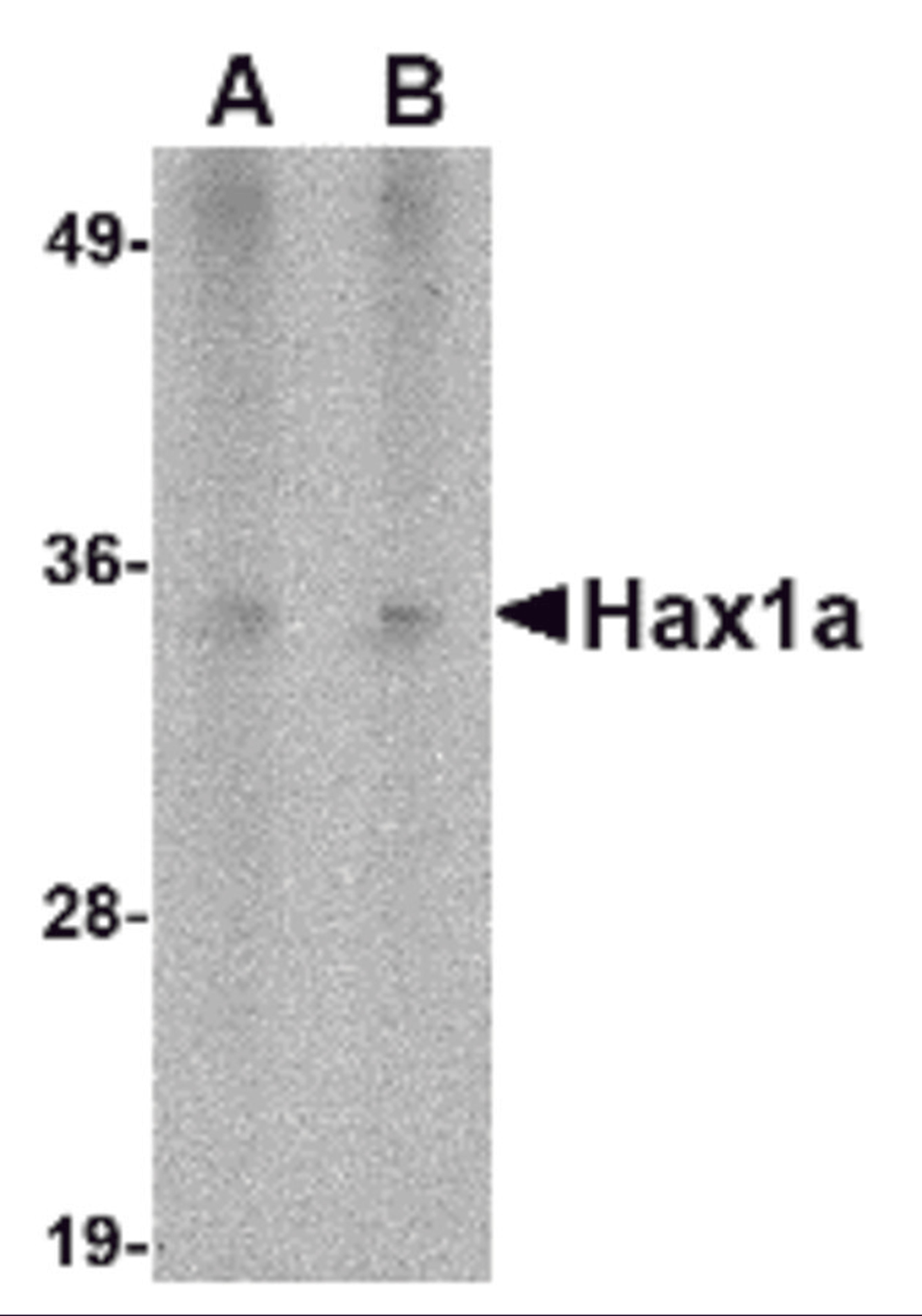 Western blot analysis of Hax1a in human heart tissue lysate with Hax1a antibody at (A) 1 and (B) 2 &#956;g/mL.