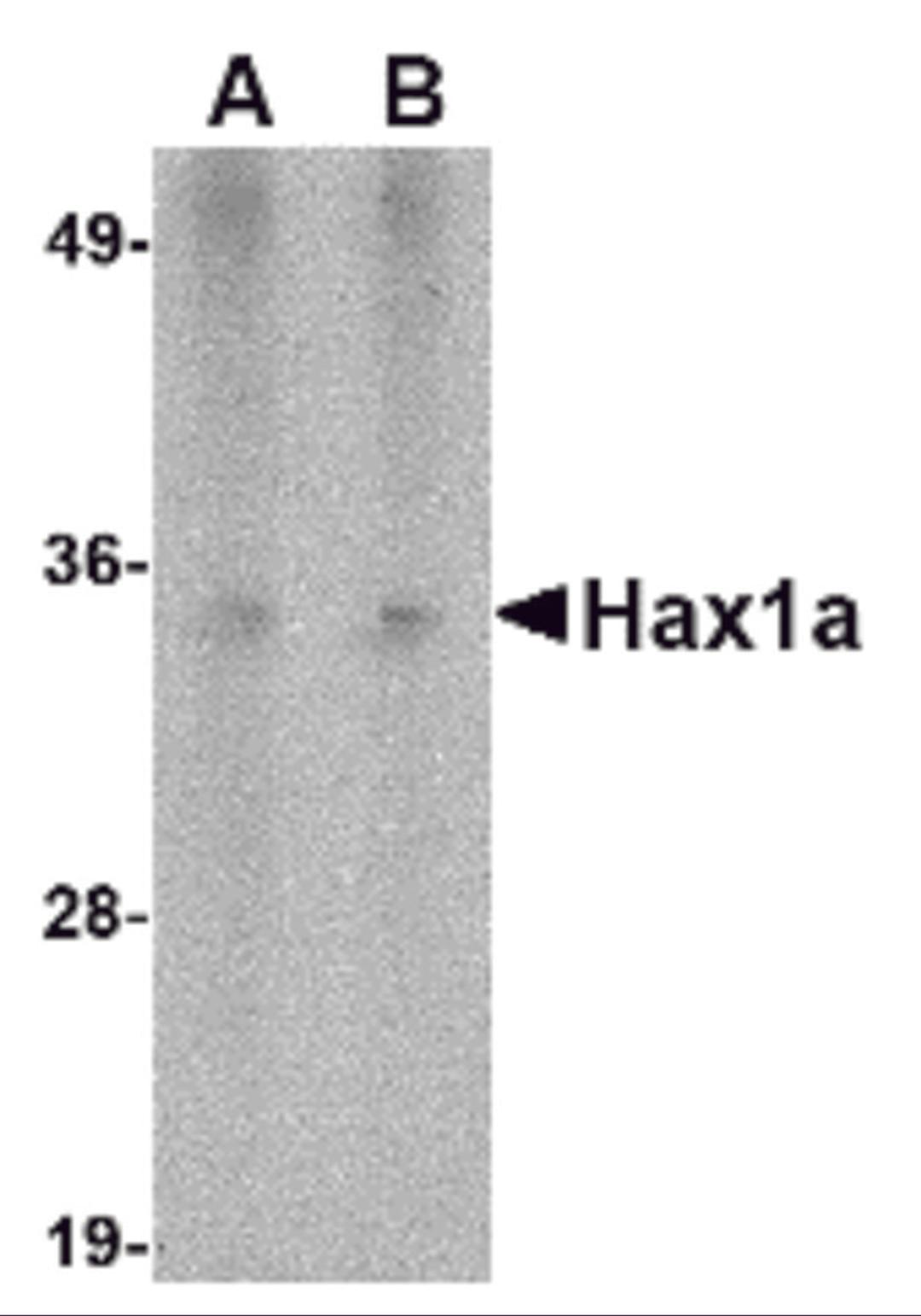 Western blot analysis of Hax1a in human heart tissue lysate with Hax1a antibody at (A) 1 and (B) 2 μg/mL.