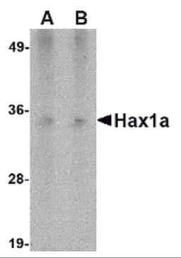Western blot analysis of Hax1a in human heart tissue lysate with Hax1a antibody at (A) 1 and (B) 2 μg/mL.