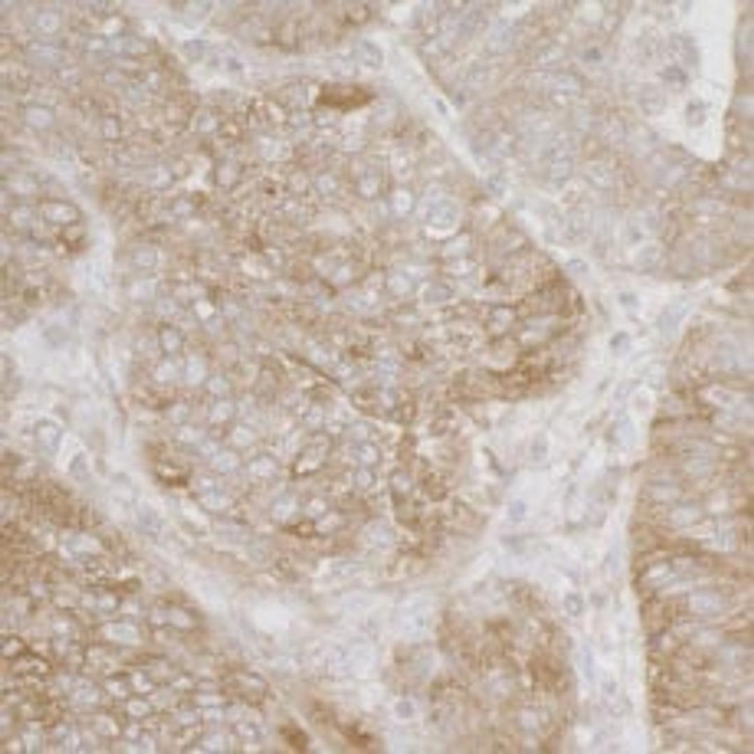 Detection of human Ribosomal Protein S3A by immunohistochemistry.