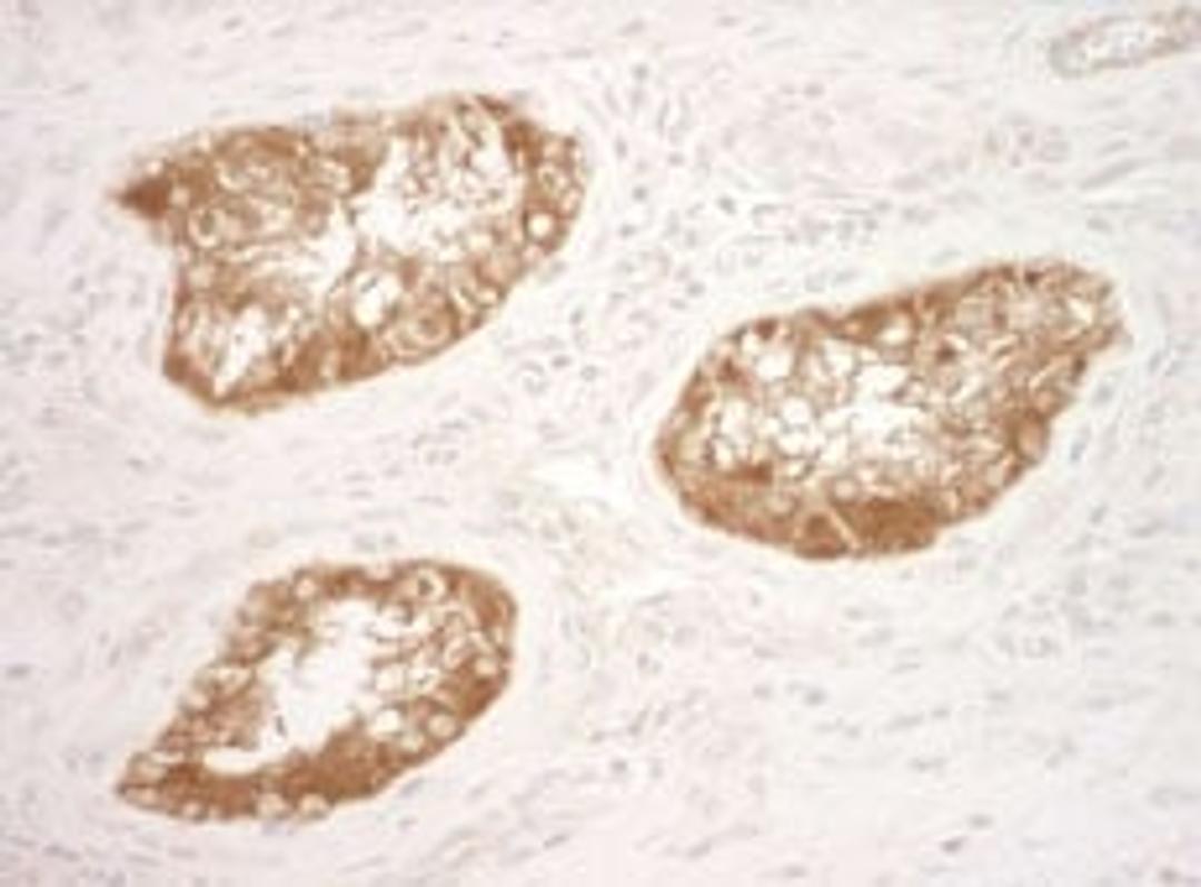 Detection of human Vinculin by immunohistochemistry.