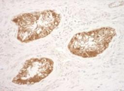 Detection of human Vinculin by immunohistochemistry.