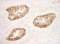 Detection of human Vinculin by immunohistochemistry.