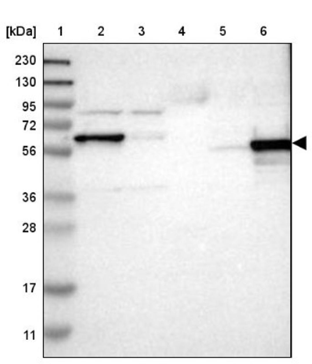 Western Blot: ICA1 Antibody [NBP1-83124] - Lane 1: Marker [kDa] 230, 130, 95, 72, 56, 36, 28, 17, 11<br/>Lane 2: Human cell line RT-4<br/>Lane 3: Human cell line U-251MG sp<br/>Lane 4: Human plasma (IgG/HSA depleted)<br/>Lane 5: Human liver tissue<br/>Lane 6: Human tonsil tissue