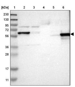 Western Blot: ICA1 Antibody [NBP1-83124] - Lane 1: Marker [kDa] 230, 130, 95, 72, 56, 36, 28, 17, 11<br/>Lane 2: Human cell line RT-4<br/>Lane 3: Human cell line U-251MG sp<br/>Lane 4: Human plasma (IgG/HSA depleted)<br/>Lane 5: Human liver tissue<br/>Lane 6: Human tonsil tissue