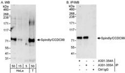 Detection of human Spindly/CCDC99 by western blot and immunoprecipitation.