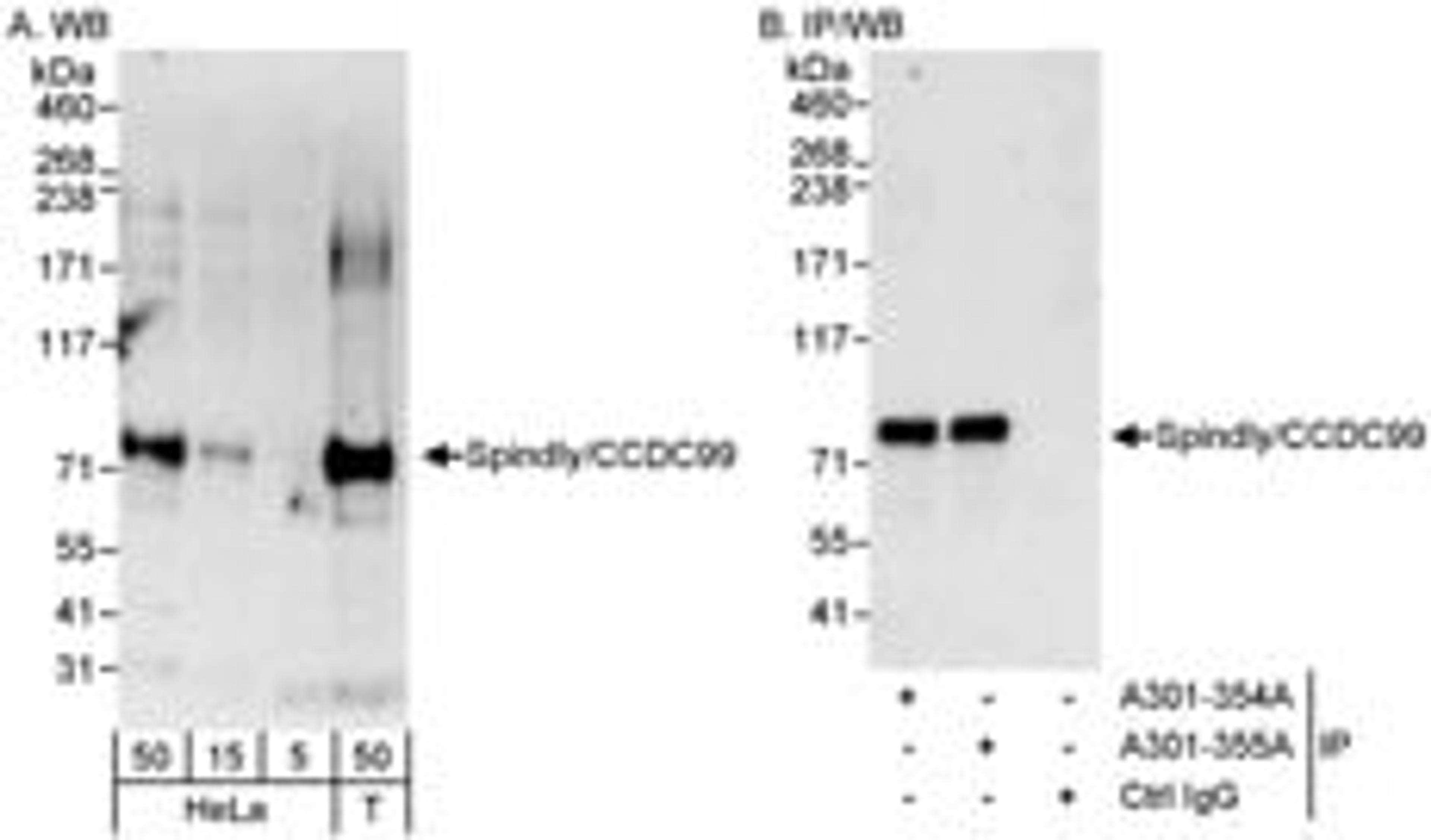 Detection of human Spindly/CCDC99 by western blot and immunoprecipitation.