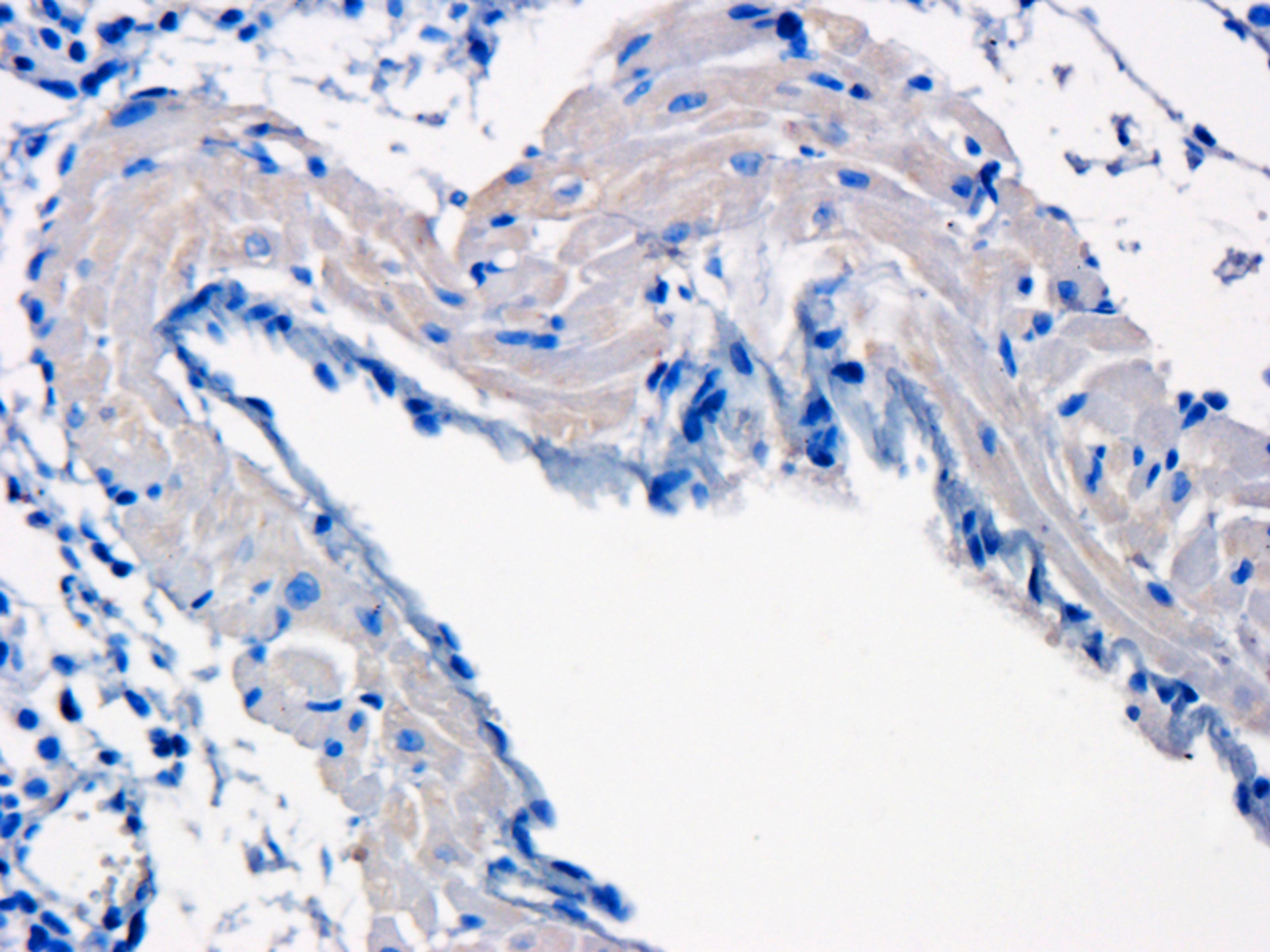 Immunohistochemical staining of mouse lung tissue using KLF2 antibody (dilution of primary antibody - 1:200)