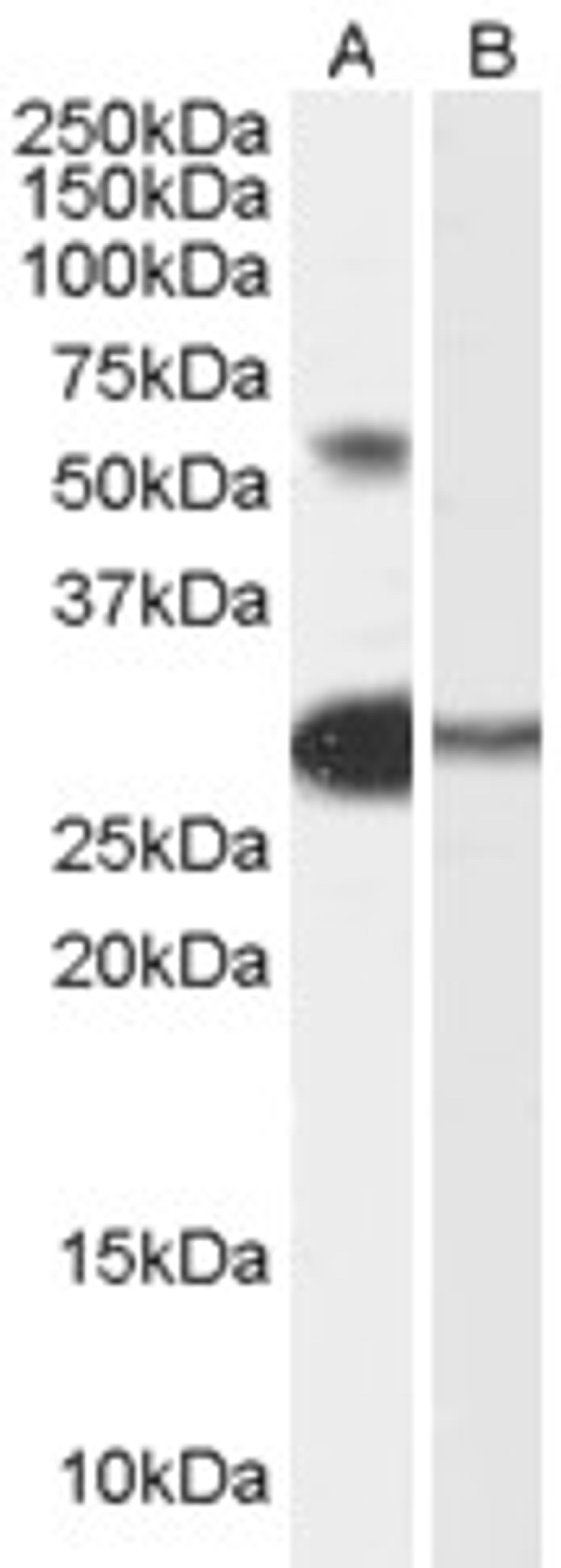 46-475 (0.3ug/ml) staining of Human Testis lysate (35ug protein in RIPA buffer) with (B) and without (A) blocking with the immunising peptide. Primary incubation was 1 hour. Detected by chemiluminescence.