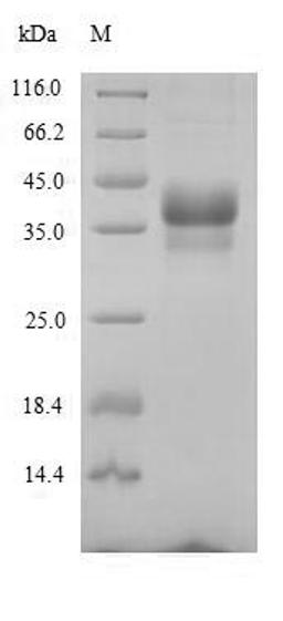 (Tris-Glycine gel) Discontinuous SDS-PAGE (reduced) with 5% enrichment gel and 15% separation gel.