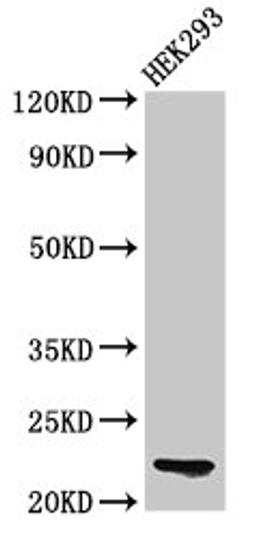 Western Blot. Positive WB detected in: HEK293 whole cell lysate. All lanes: HIST1H1E antibody at 0.1µg/ml. Secondary. Goat polyclonal to rabbit IgG at 1/50000 dilution. Predicted band size: 22 kDa. Observed band size: 22 kDa