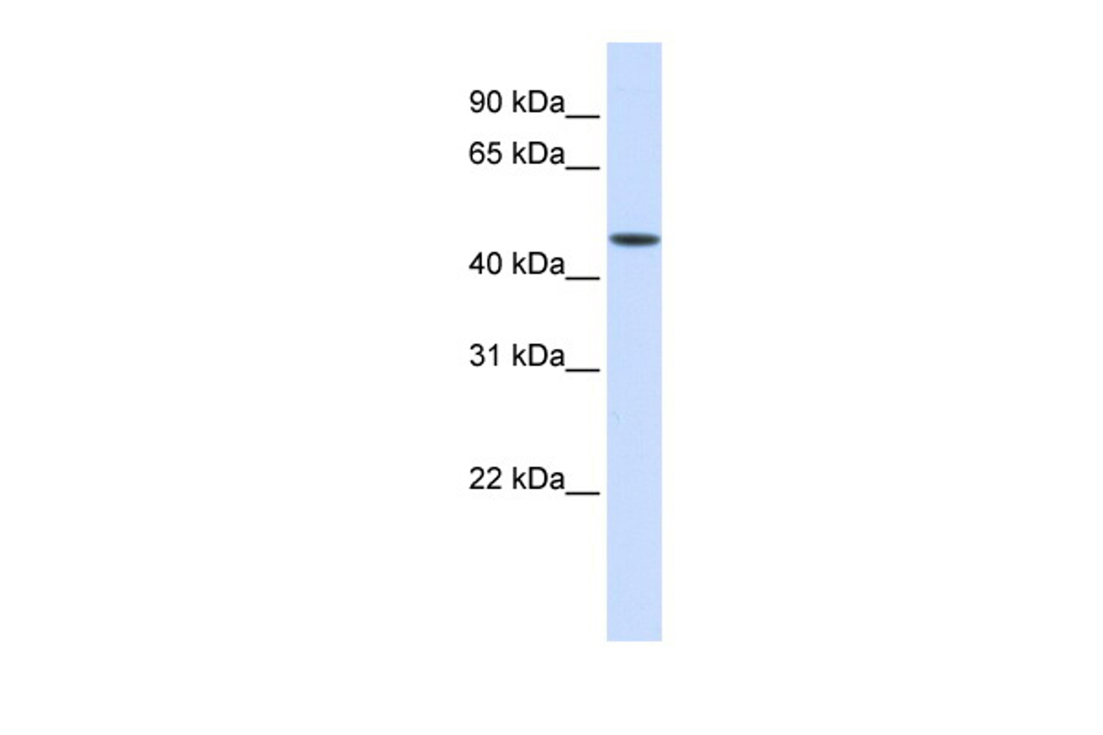 Antibody used in WB on Human Liver at 0.2-1 ug/ml.