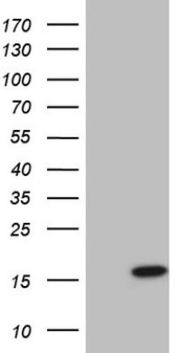 Western Blot: UbcH5b/UBE2D2 Antibody (2C2) [NBP2-46270] - Analysis of HEK293T cells were transfected with the pCMV6-ENTRY control (Left lane) or pCMV6-ENTRY UBE2D2.