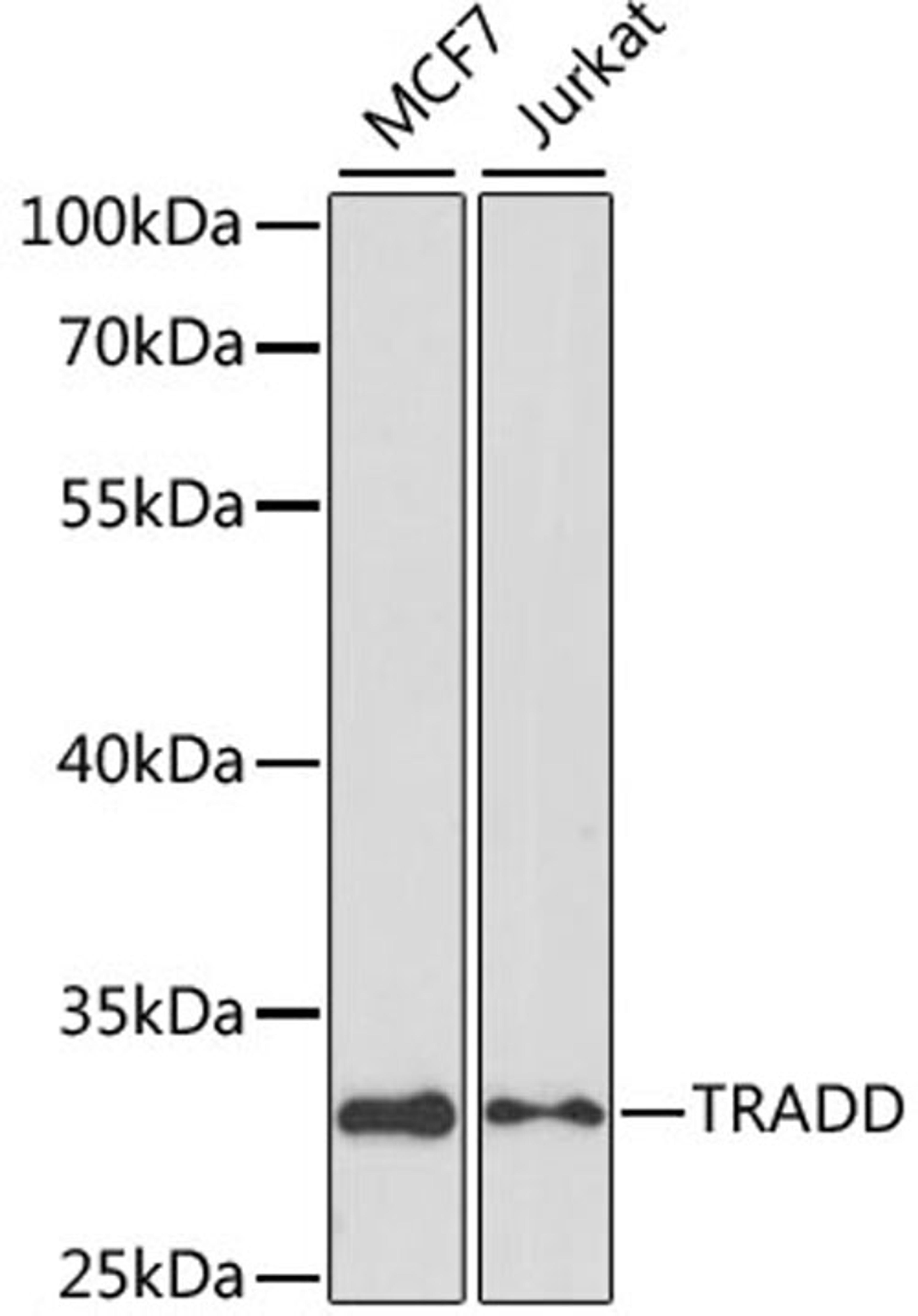 Western blot - TRADD antibody (A1145)