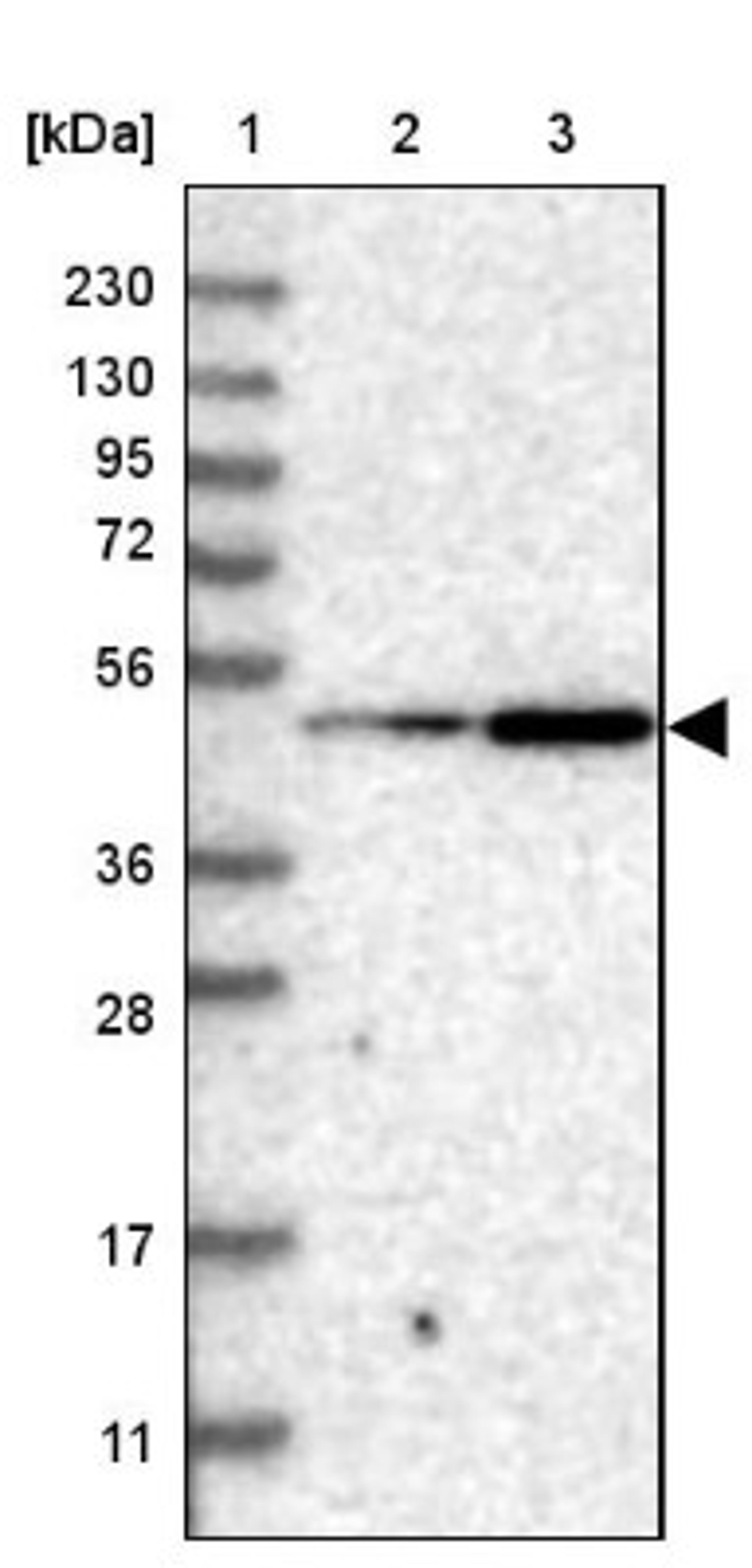 Western Blot: LIS1 Antibody [NBP1-87769] - Lane 1: Marker [kDa] 230, 130, 95, 72, 56, 36, 28, 17, 11<br/>Lane 2: Human cell line RT-4<br/>Lane 3: Human cell line U-251MG sp