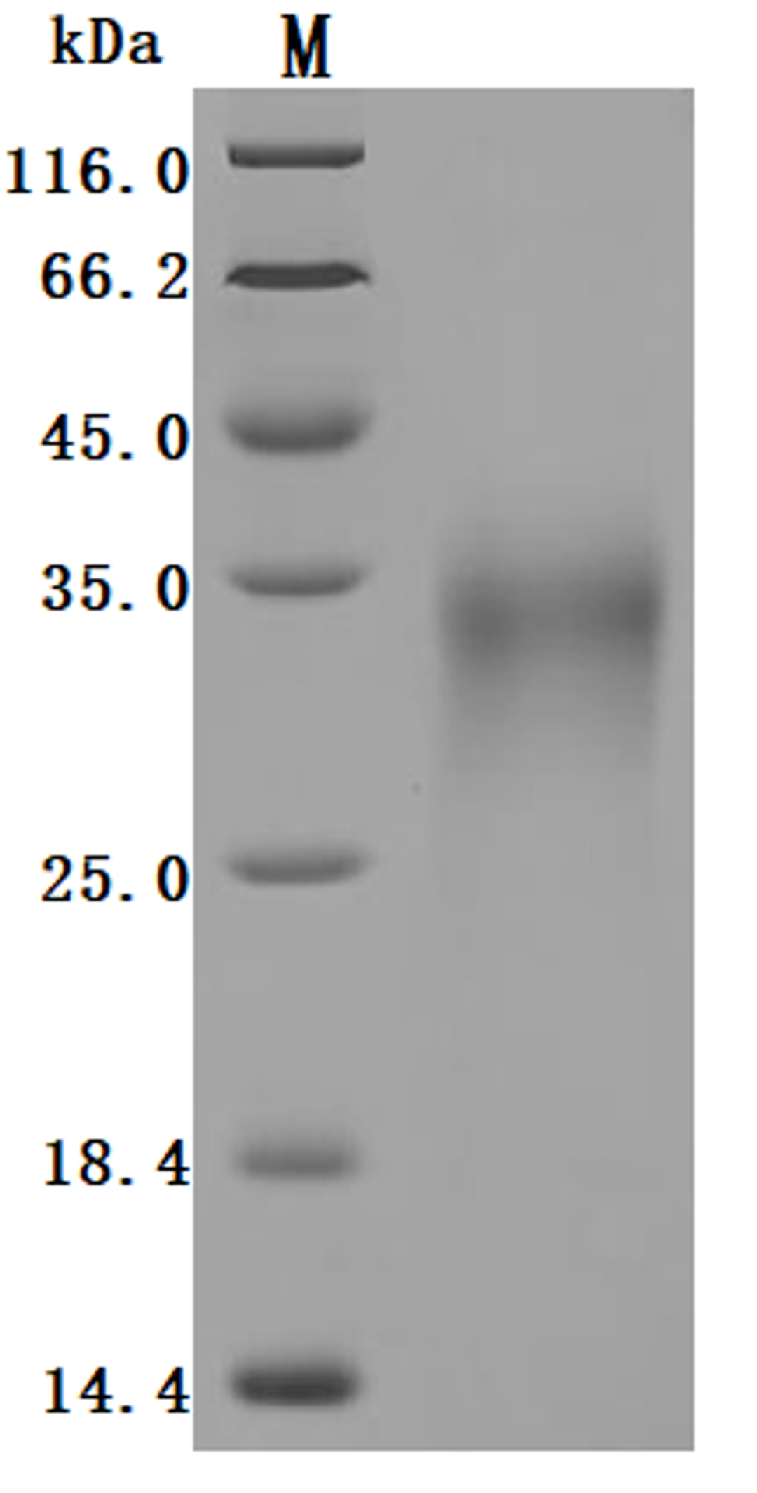 (Tris-Glycine gel) Discontinuous SDS-PAGE (reduced) with 5% enrichment gel and 15% separation gel.