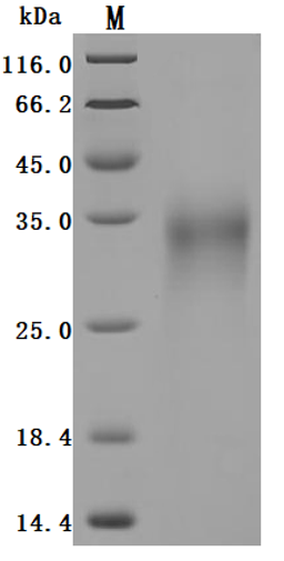 (Tris-Glycine gel) Discontinuous SDS-PAGE (reduced) with 5% enrichment gel and 15% separation gel.