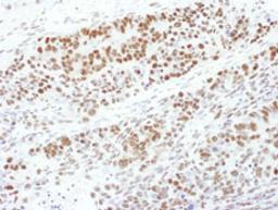 Detection of mouse Phospho-MEK1 (T286) by immunohistochemistry.