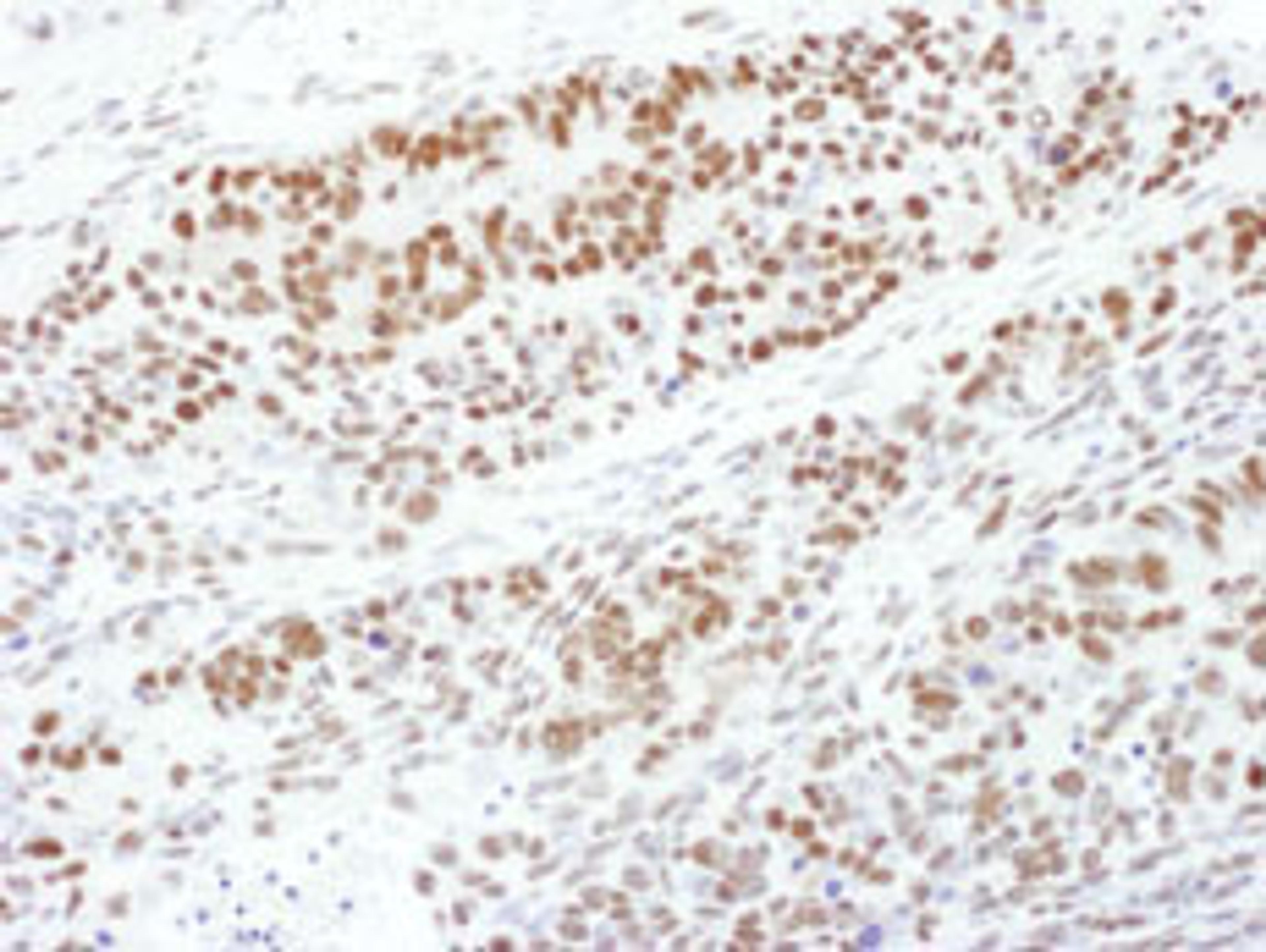 Detection of mouse Phospho-MEK1 (T286) by immunohistochemistry.