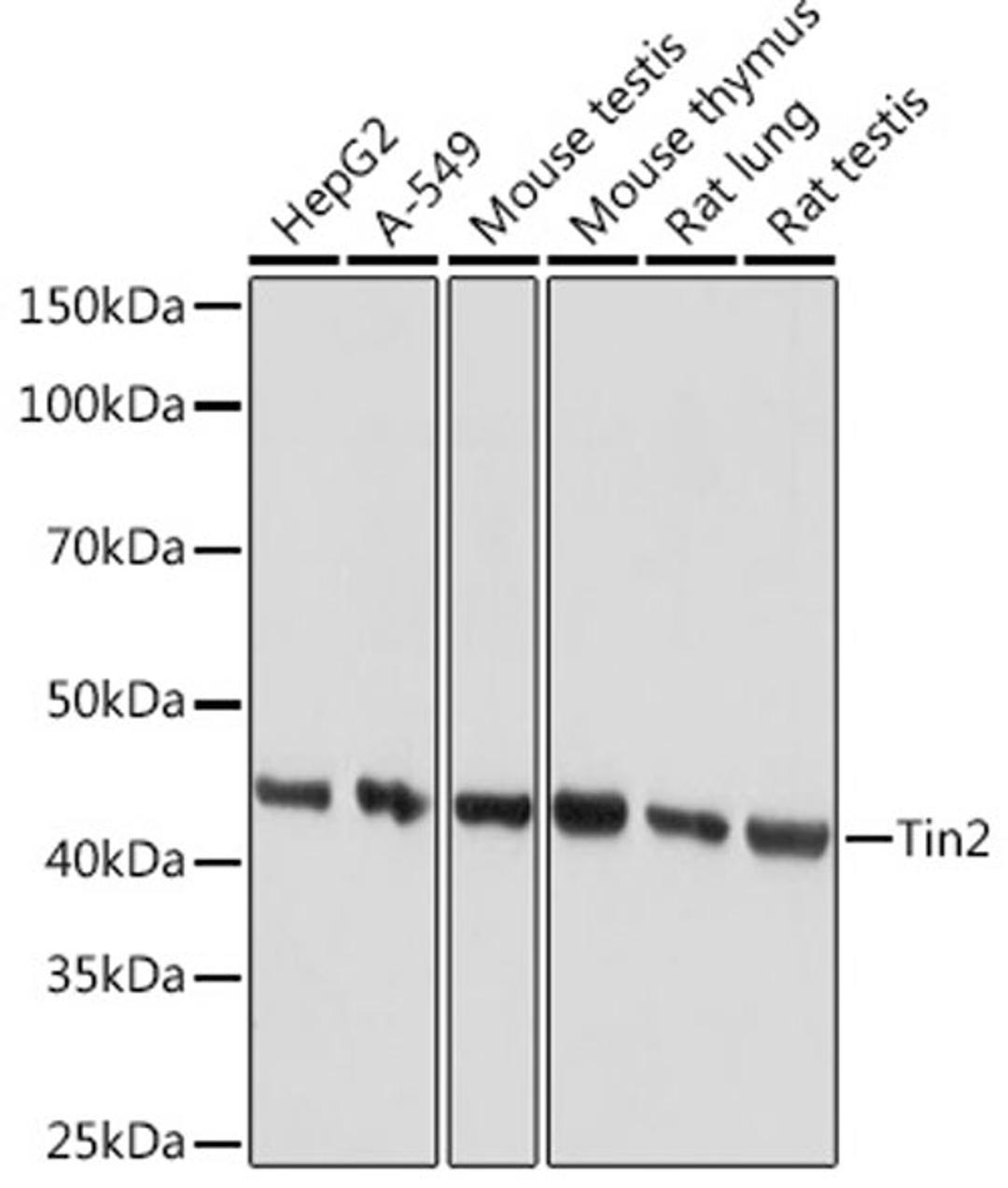 Western blot - Tin2 Rabbit mAb (A9750)