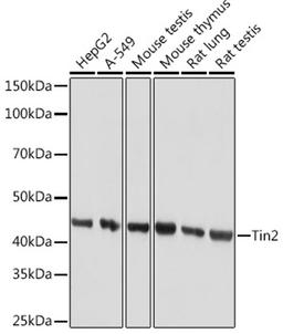 Western blot - Tin2 Rabbit mAb (A9750)