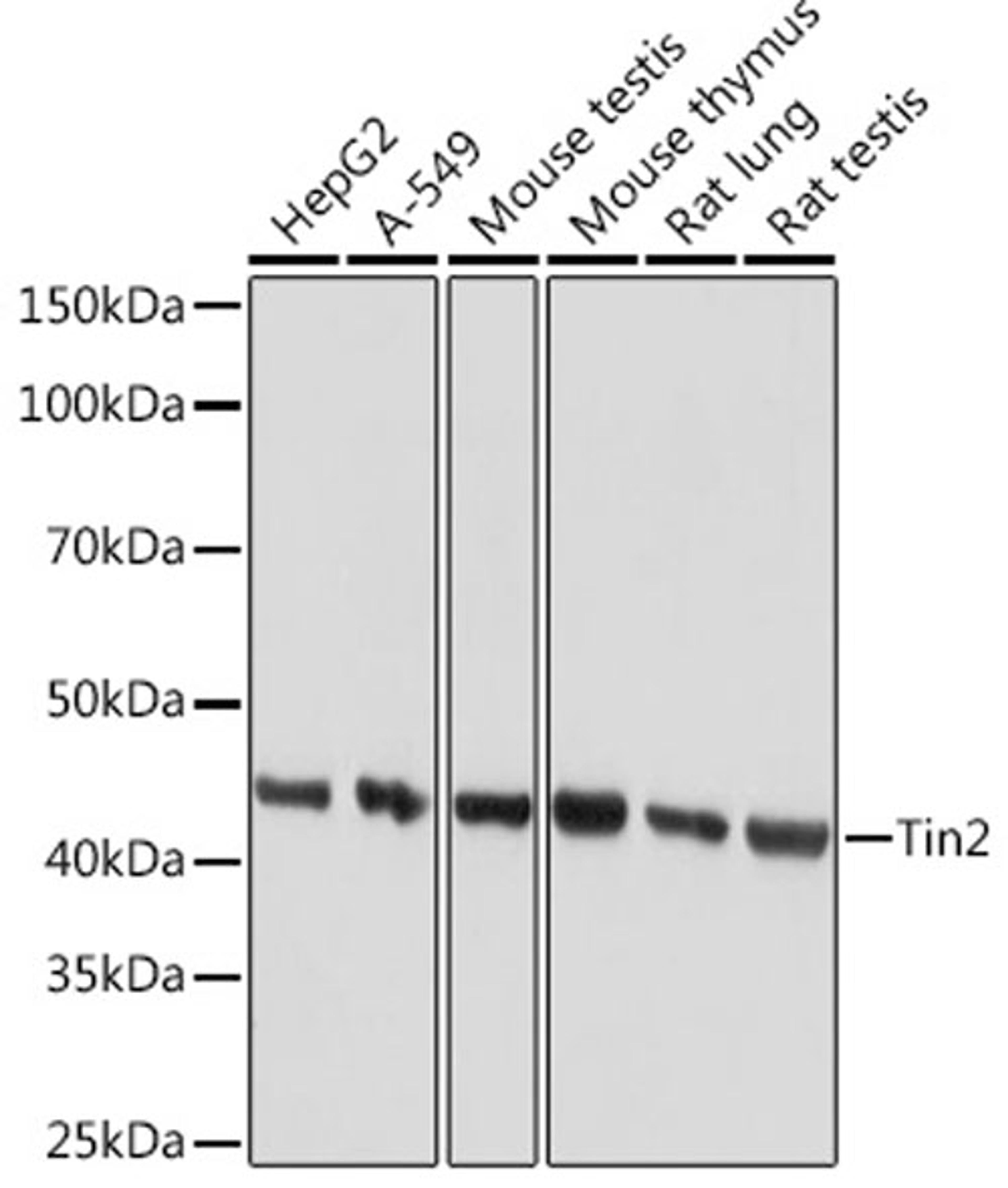 Western blot - Tin2 Rabbit mAb (A9750)