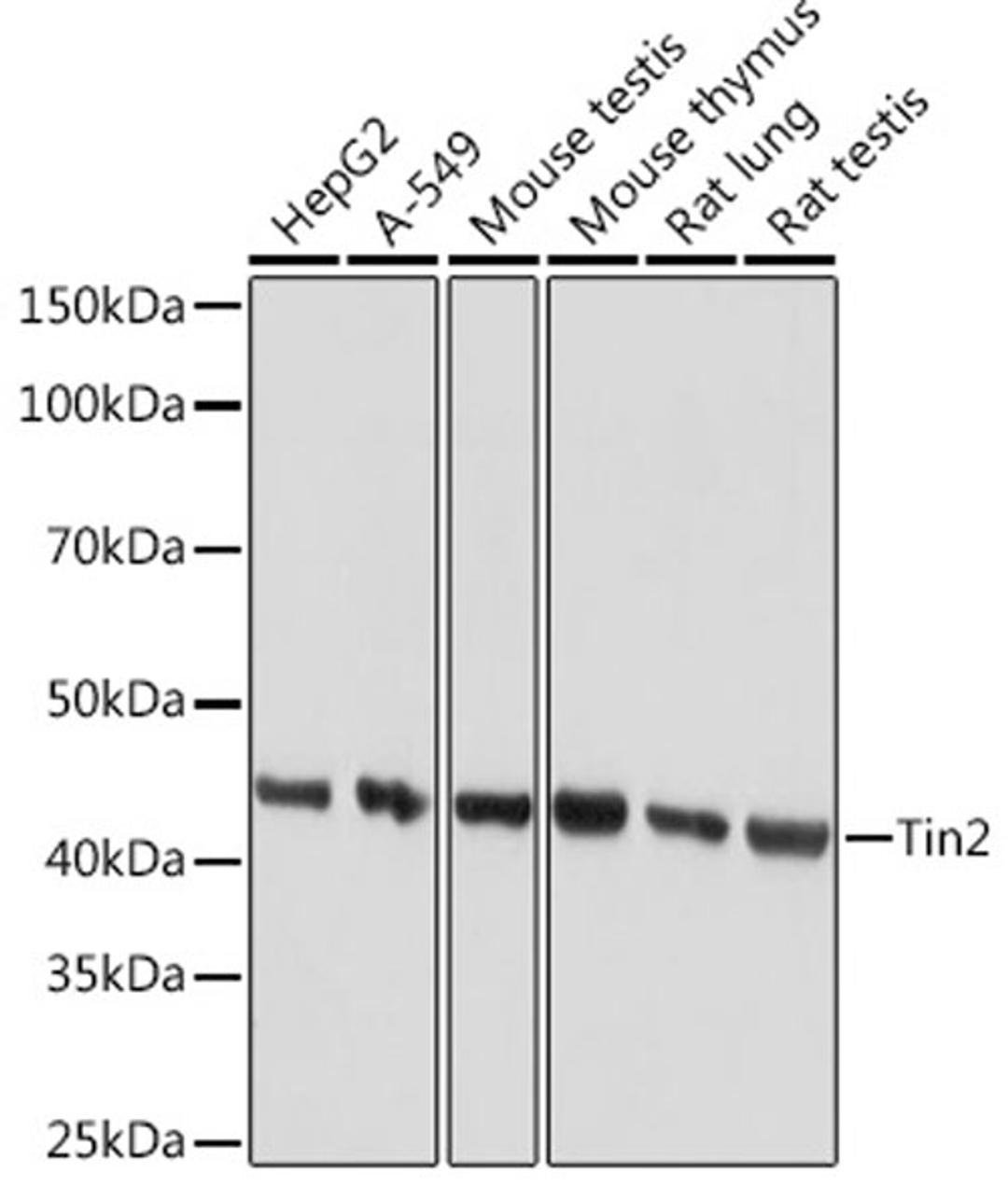 Western blot - Tin2 Rabbit mAb (A9750)