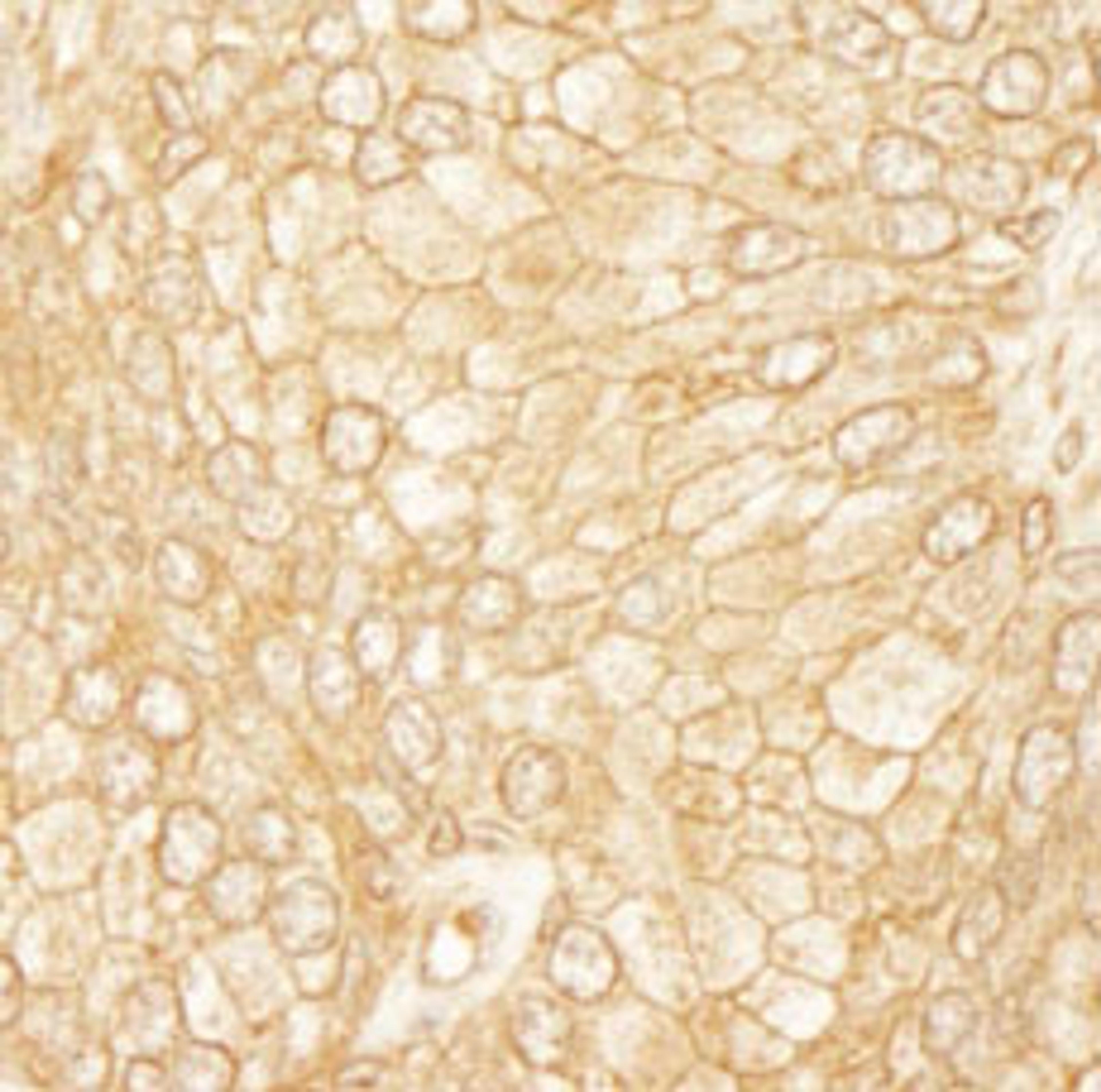 Detection of human PDZ-RhoGEF by immunohistochemistry.