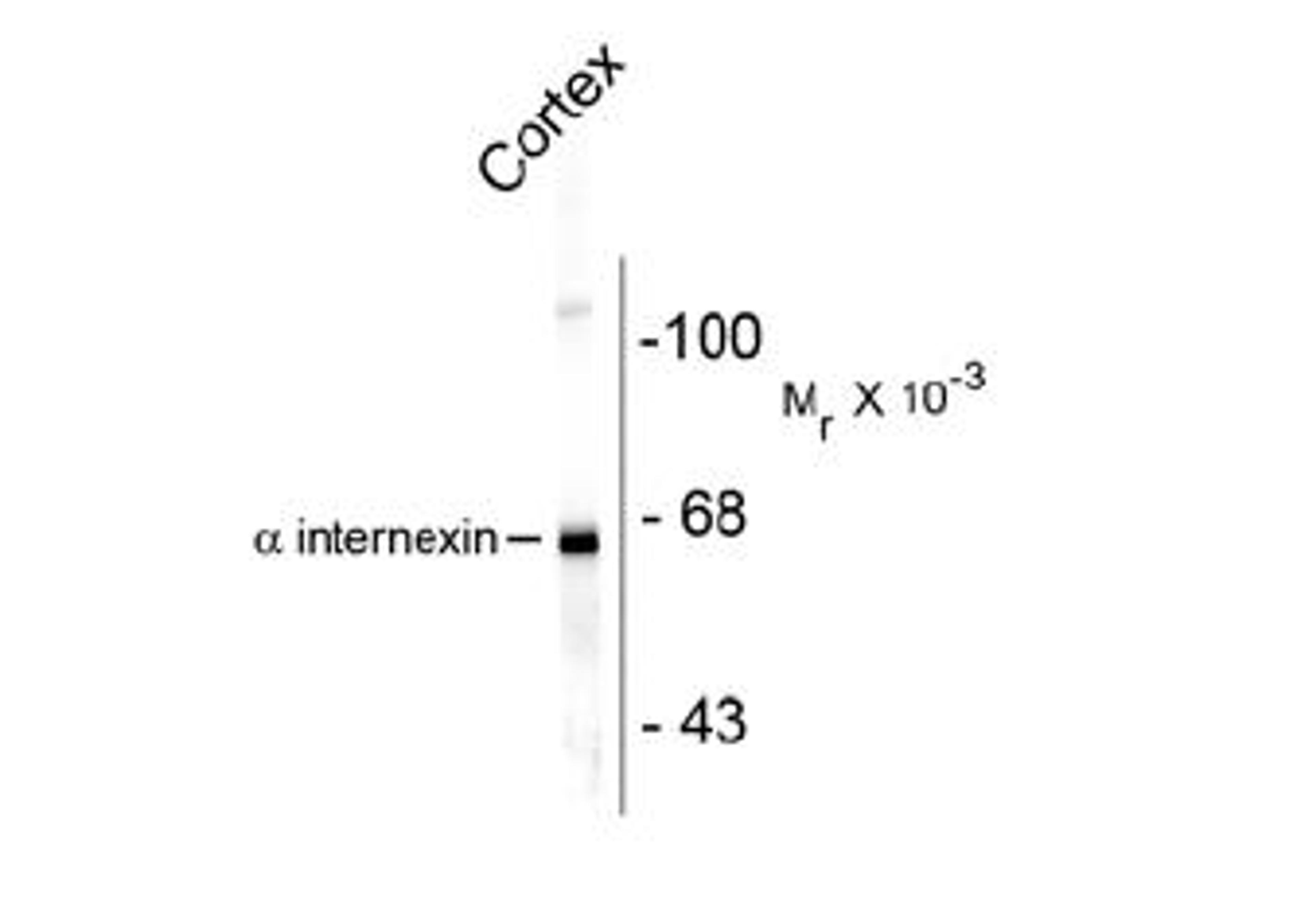 Western blot of rat cortex lysate showing specific immunolabeling of the ~ 66k alpha internexin protein.