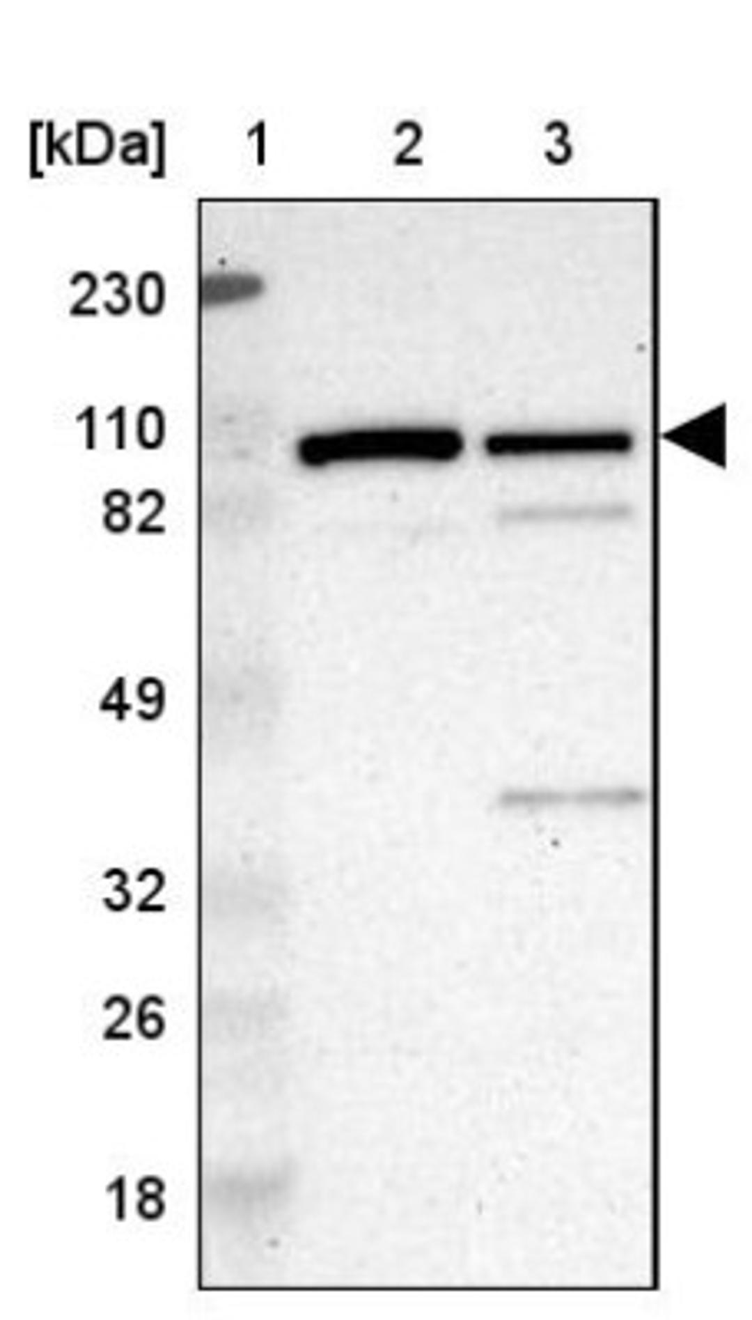 Western Blot: Methionyl tRNA synthetase Antibody [NBP1-87730] - Lane 1: Marker [kDa] 230, 110, 82, 49, 32, 26, 18<br/>Lane 2: Human cell line RT-4<br/>Lane 3: Human cell line U-251MG sp