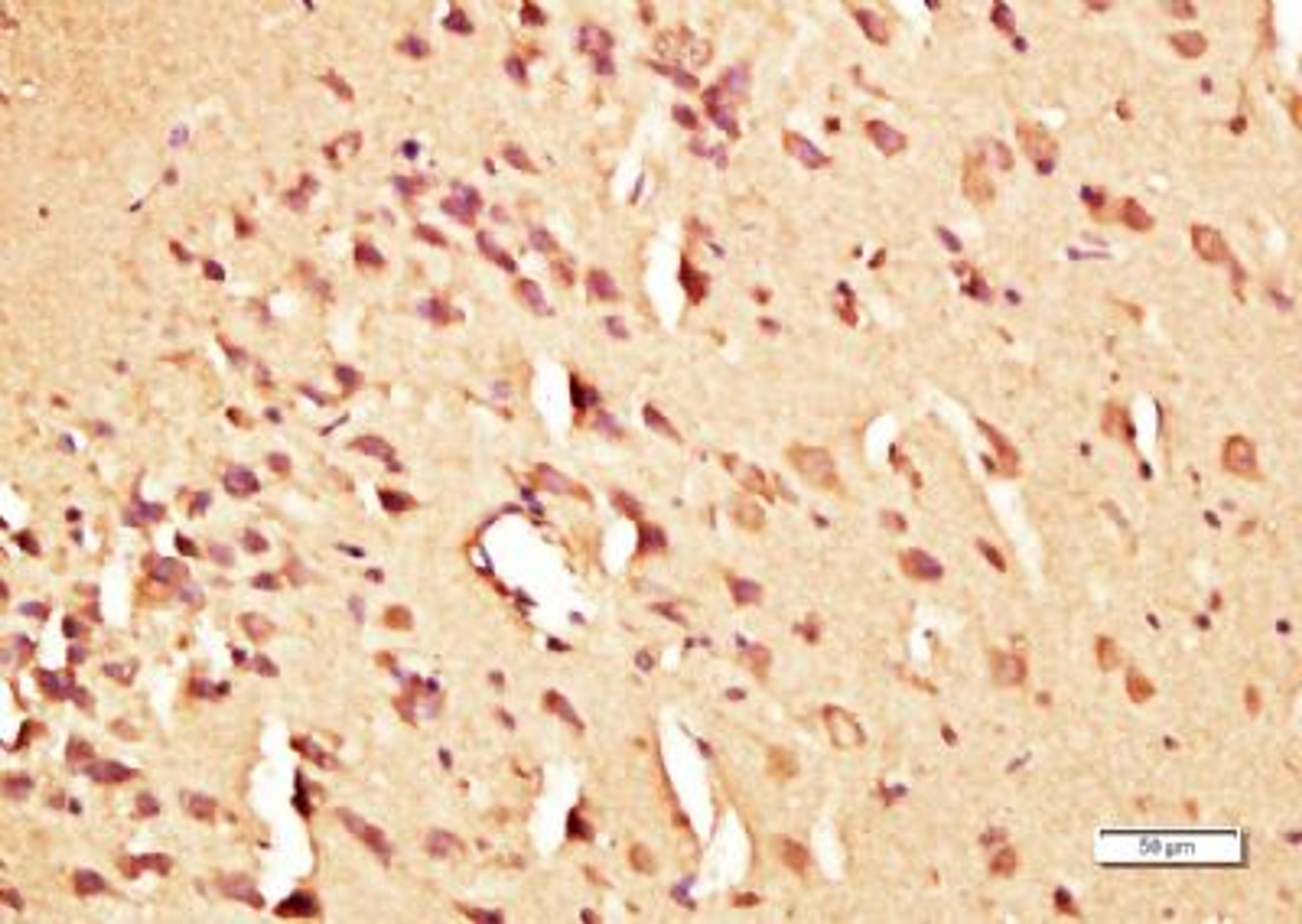 Immunohistochemical staining of rat brain tissue using FITM2 antibody.