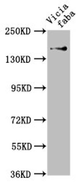 Western Blot. Positive WB detected in: Vicia faba leaf tissue. All lanes: GLU1 antibody at 1:1000. Secondary. Goat polyclonal to rabbit IgG at 1/50000 dilution. Predicted band size: 177, 180 kDa. Observed band size: 177 kDa. 