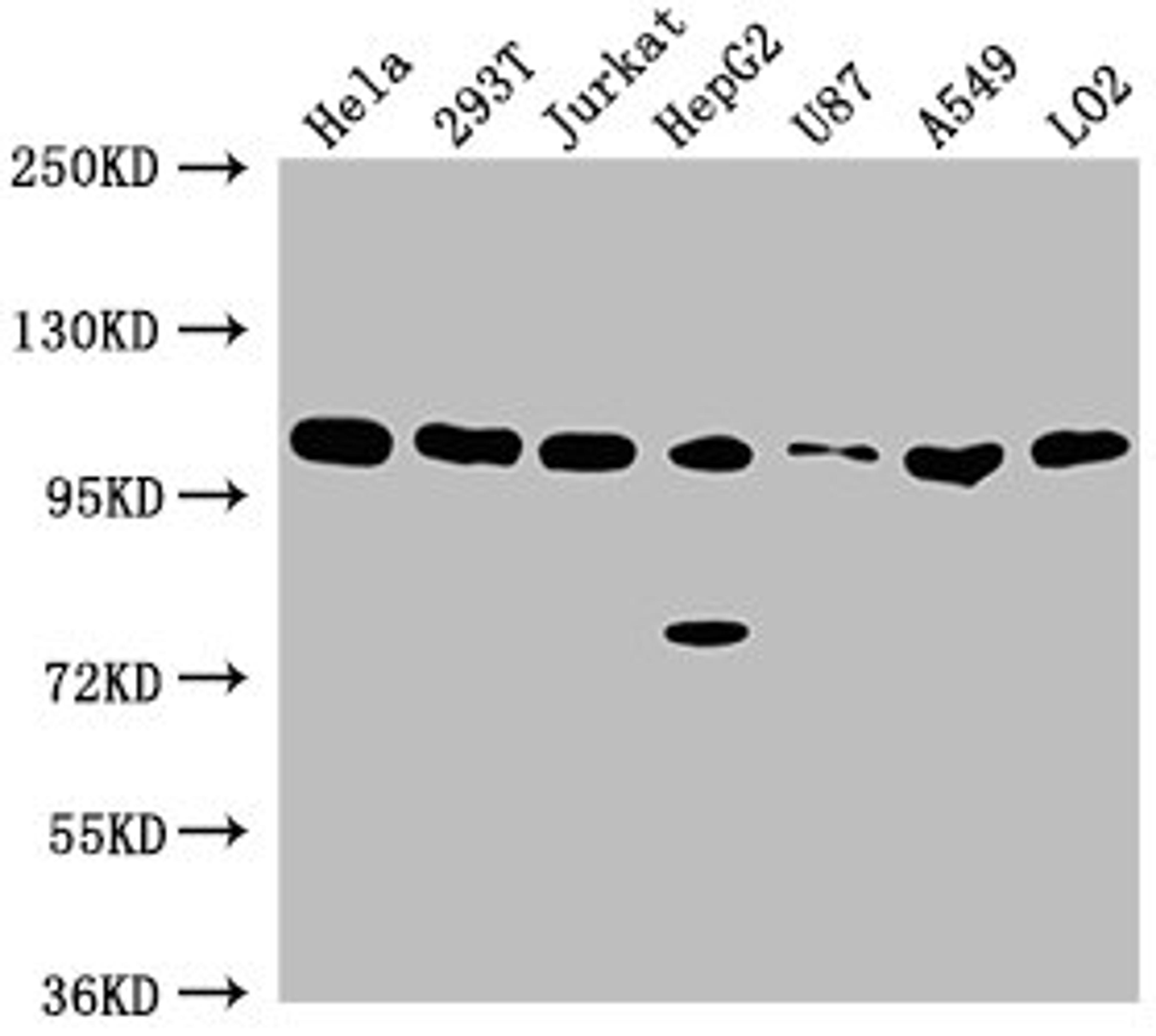 Western Blot. Positive WB detected in: Hela whole cell lysate, 293T whole cell lysate, Jurkat whole cell lysate, HepG2 whole cell lysate, U87 whole cell lysate, A549 whole cell lysate, LO2 whole cell lysate. All lanes: ADAR antibody at 1:2000. Secondary. Goat polyclonal to rabbit IgG at 1/50000 dilution. Predicted band size: 137, 134, 132, 141, 104 kDa. Observed band size: 104 kDa.