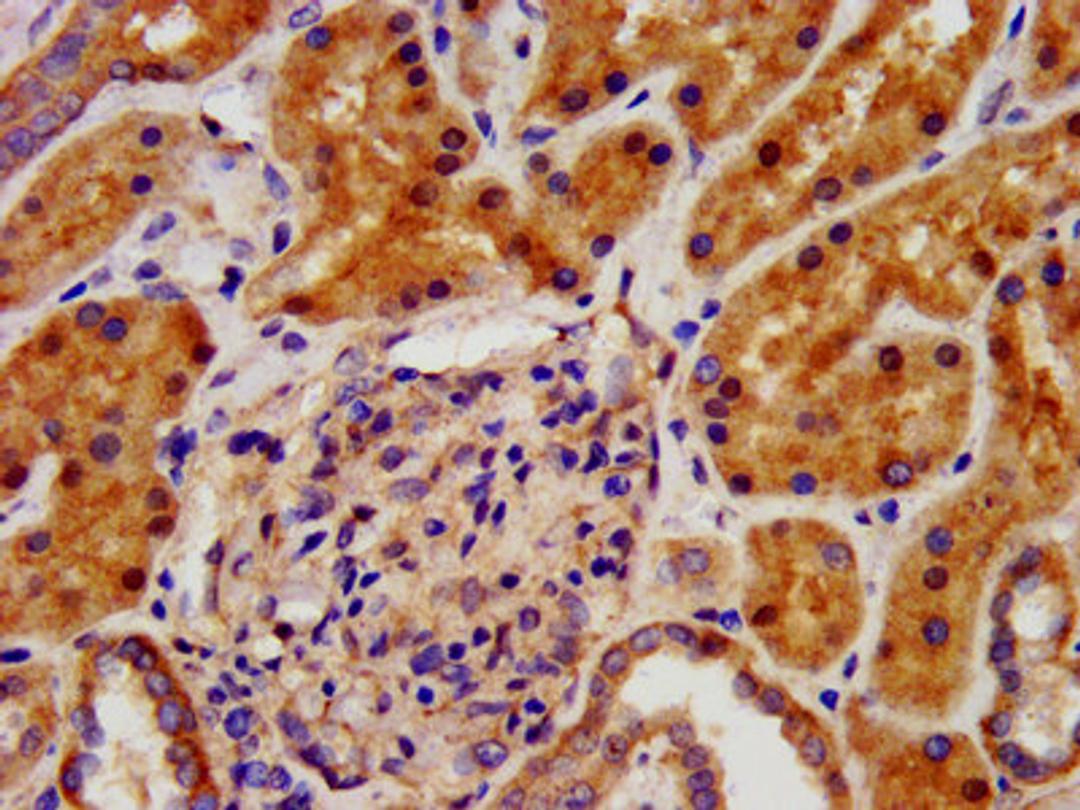 IHC image of CSB-PA622791LA01HU diluted at 1:500 and staining in paraffin-embedded human kidney tissue performed on a Leica BondTM system. After dewaxing and hydration, antigen retrieval was mediated by high pressure in a citrate buffer (pH 6.0). Section was blocked with 10% normal goat serum 30min at RT. Then primary antibody (1% BSA) was incubated at 4°C overnight. The primary is detected by a biotinylated secondary antibody and visualized using an HRP conjugated SP system.