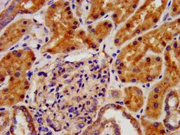 IHC image of CSB-PA622791LA01HU diluted at 1:500 and staining in paraffin-embedded human kidney tissue performed on a Leica BondTM system. After dewaxing and hydration, antigen retrieval was mediated by high pressure in a citrate buffer (pH 6.0). Section was blocked with 10% normal goat serum 30min at RT. Then primary antibody (1% BSA) was incubated at 4°C overnight. The primary is detected by a biotinylated secondary antibody and visualized using an HRP conjugated SP system.