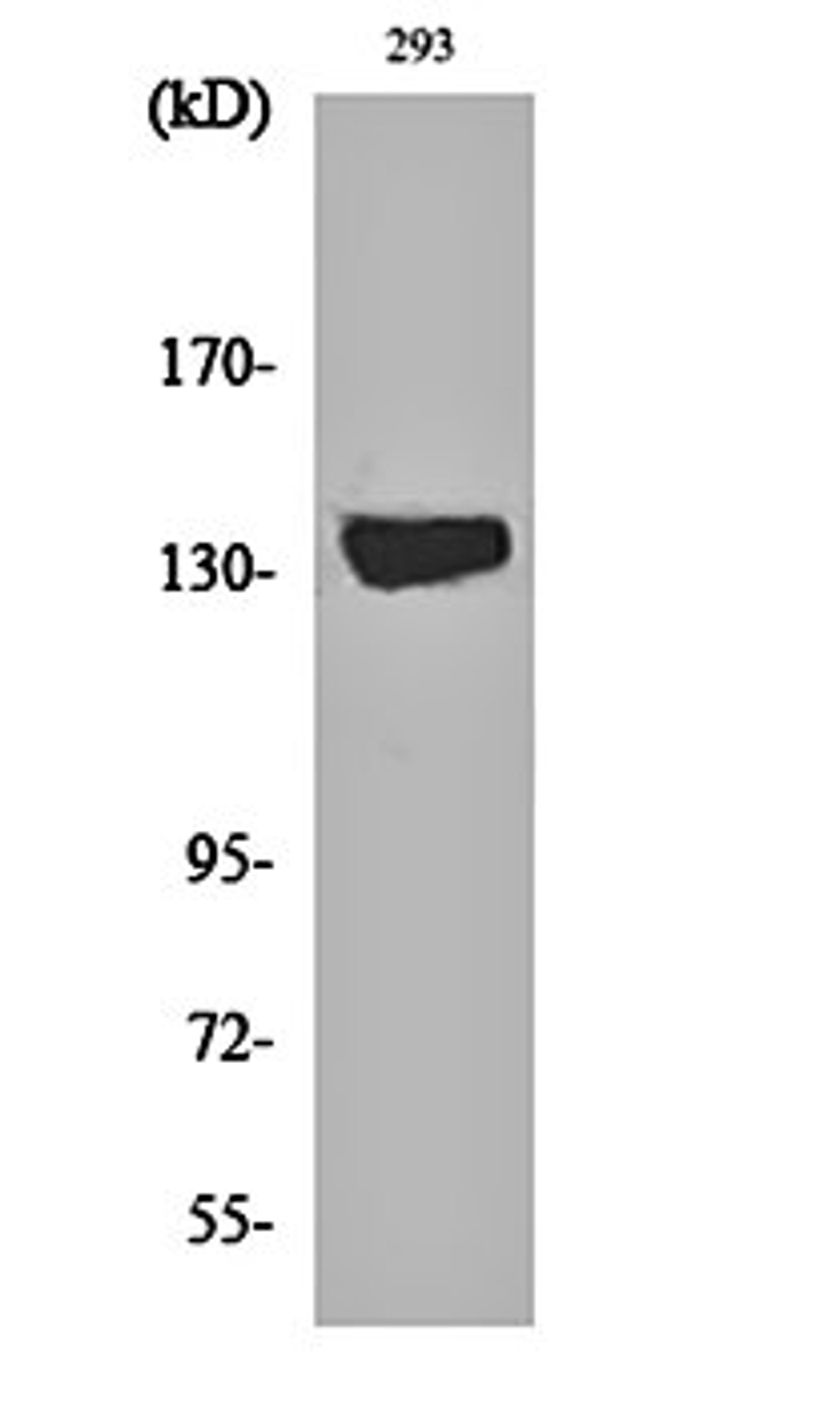 Western blot analysis of 293 cell lysates using DGK- lota antibody