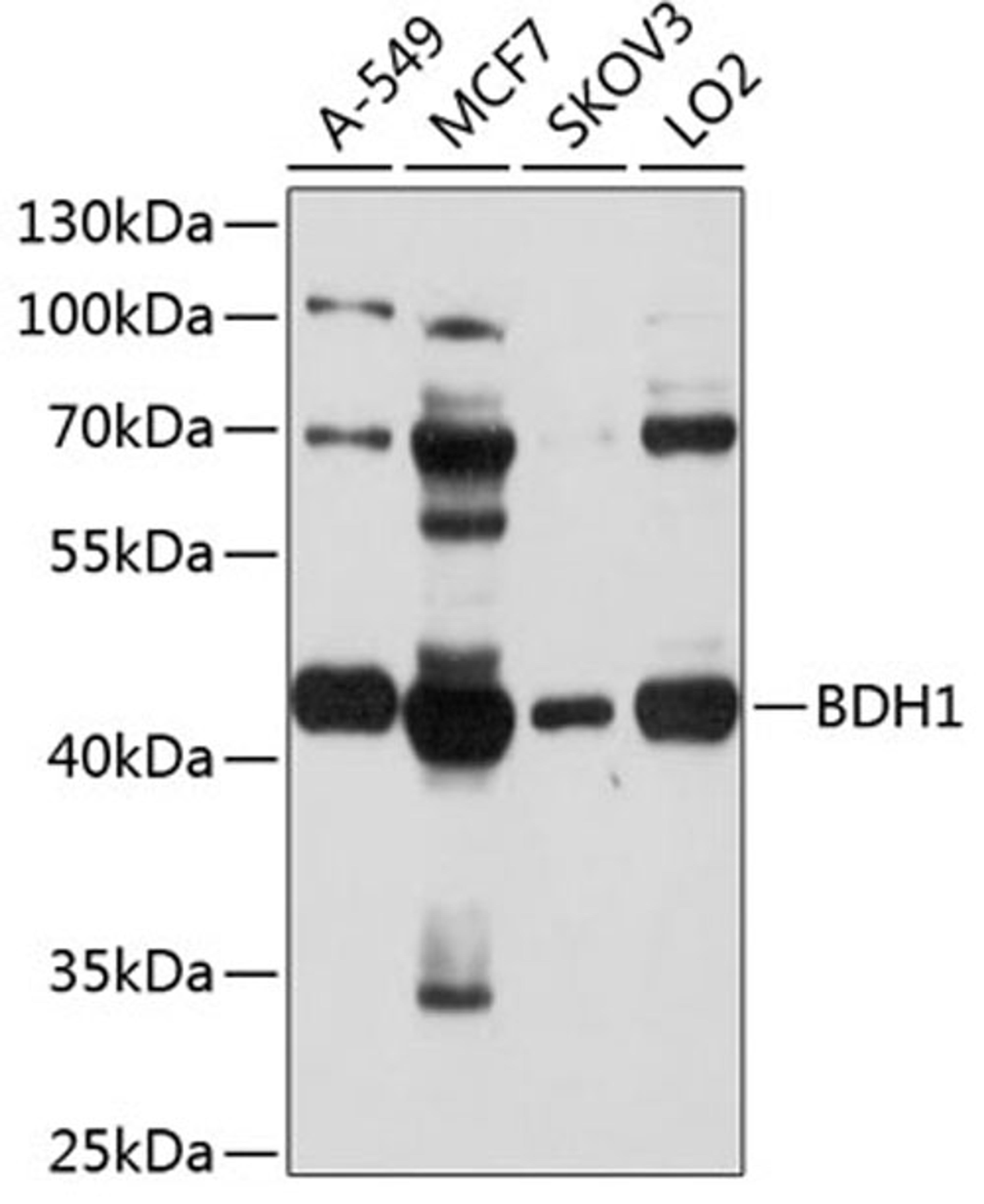 Western blot - BDH1 antibody (A3763)